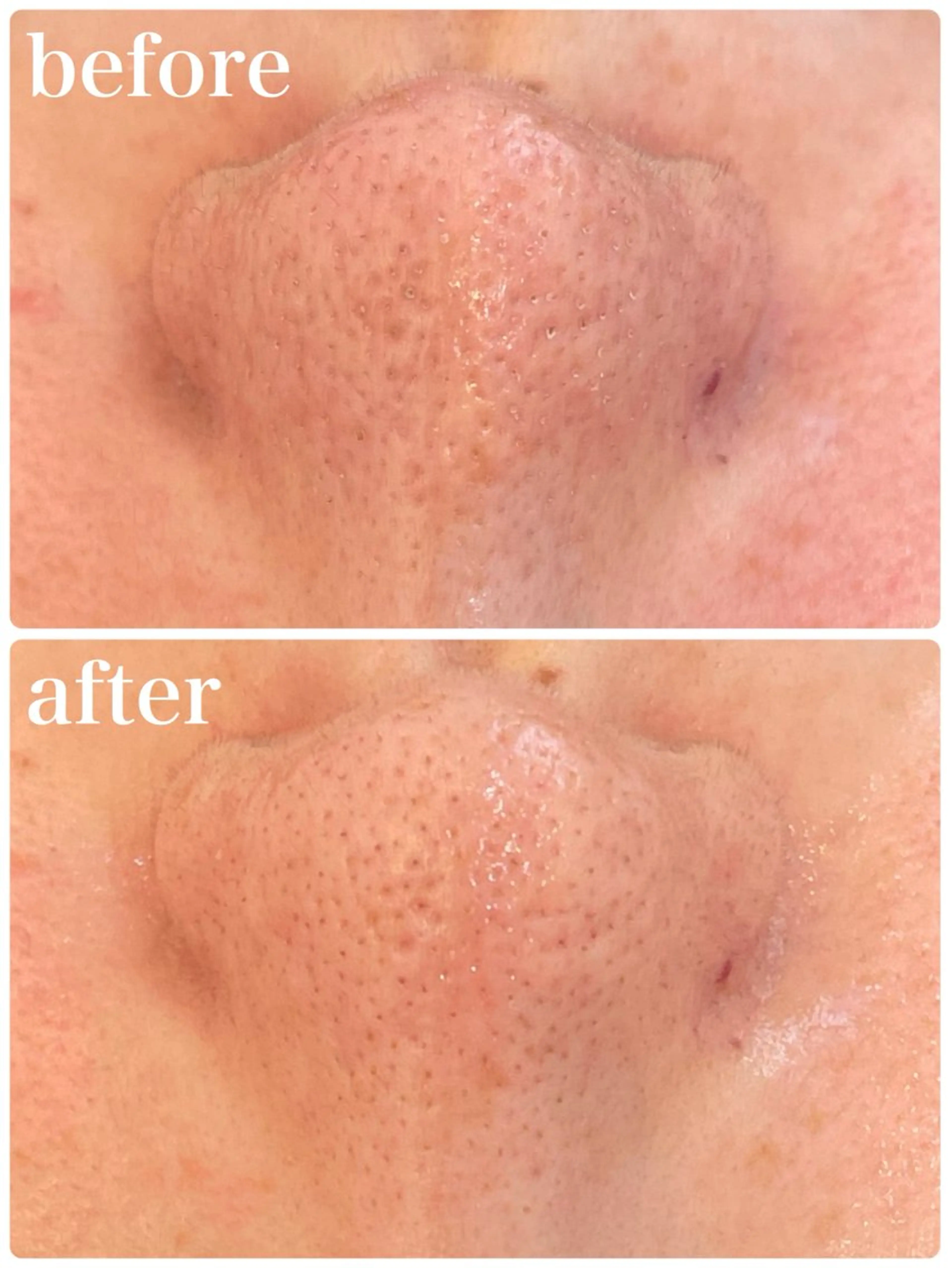 エステ リラク パーソナルスキンケア 🦋APRI🅿️有のエステ・リラクイメージ