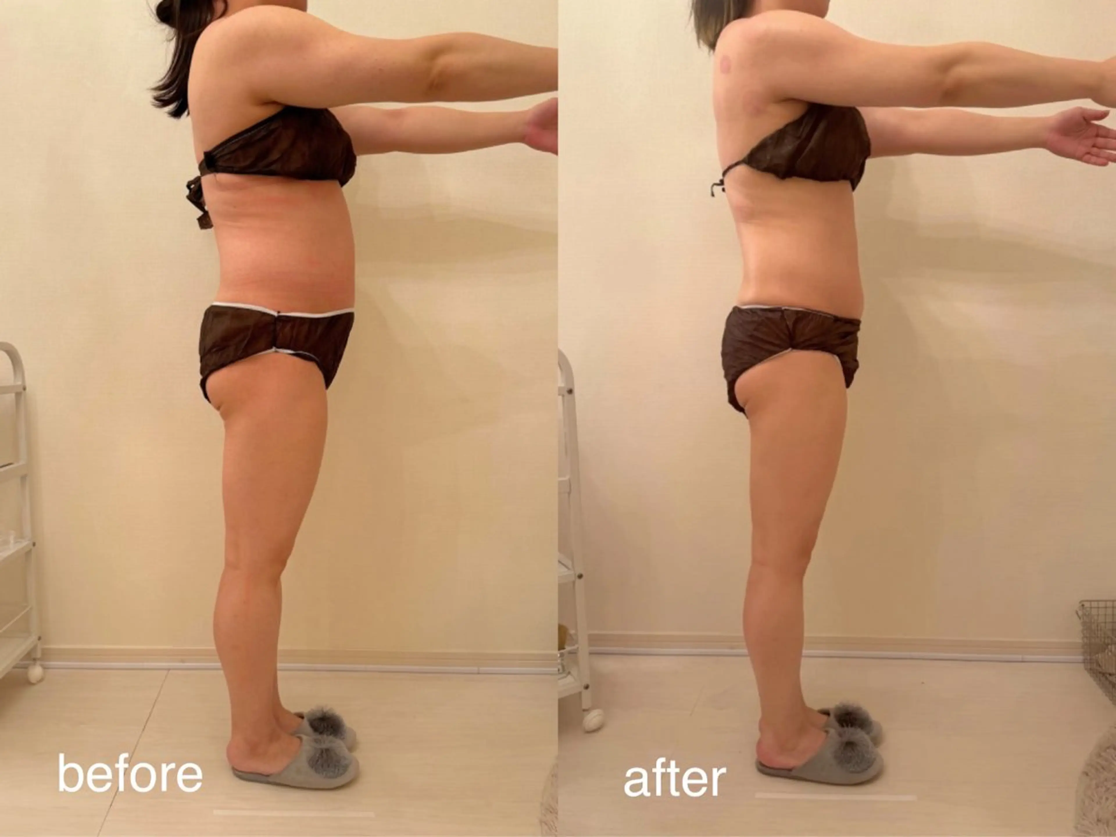 エステ 小顔×痩身専門サロンCLORE浦和店所属・石川 彩花のエステ・リラクイメージ