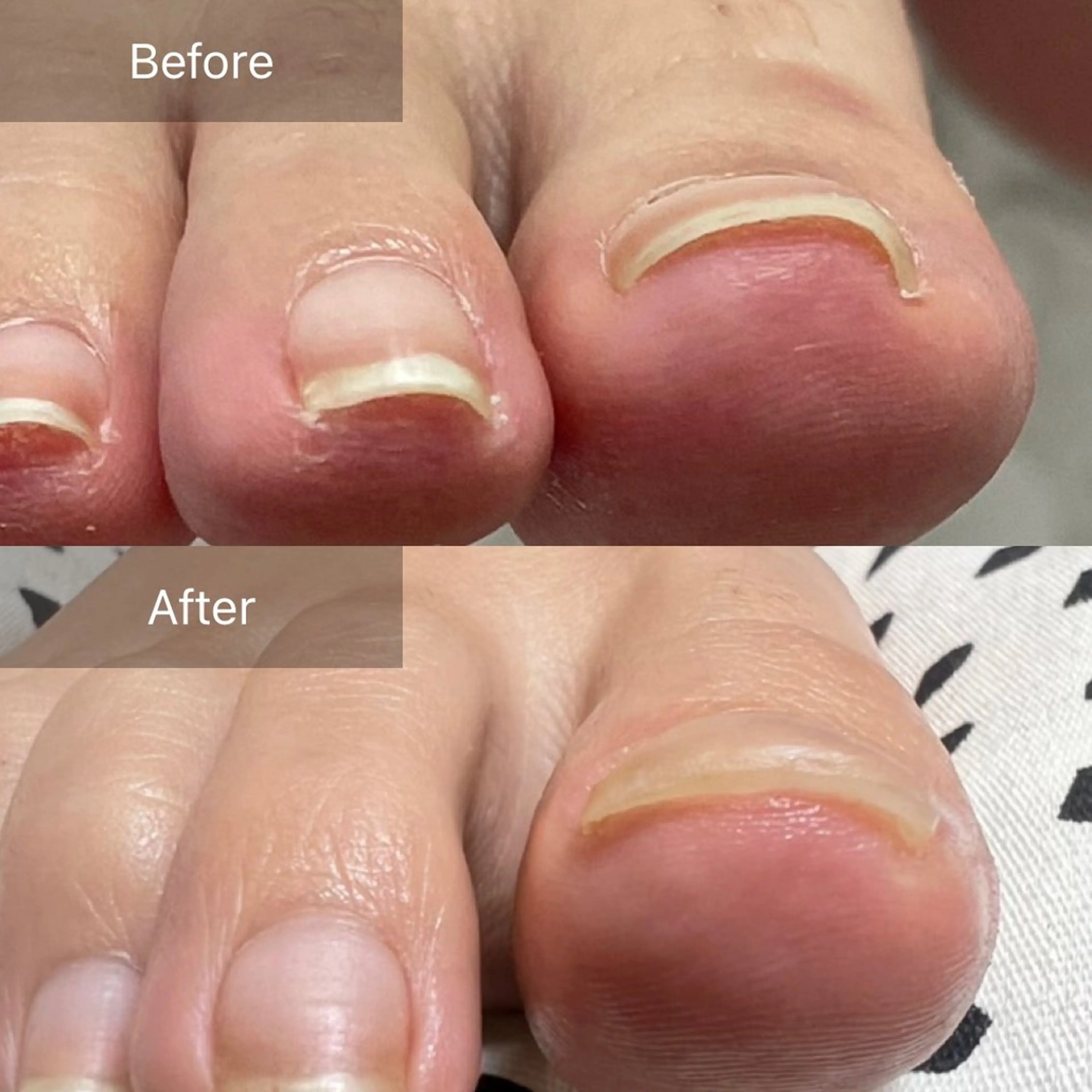 ネイル フットネイル Belulu ベルルのネイルデザイン