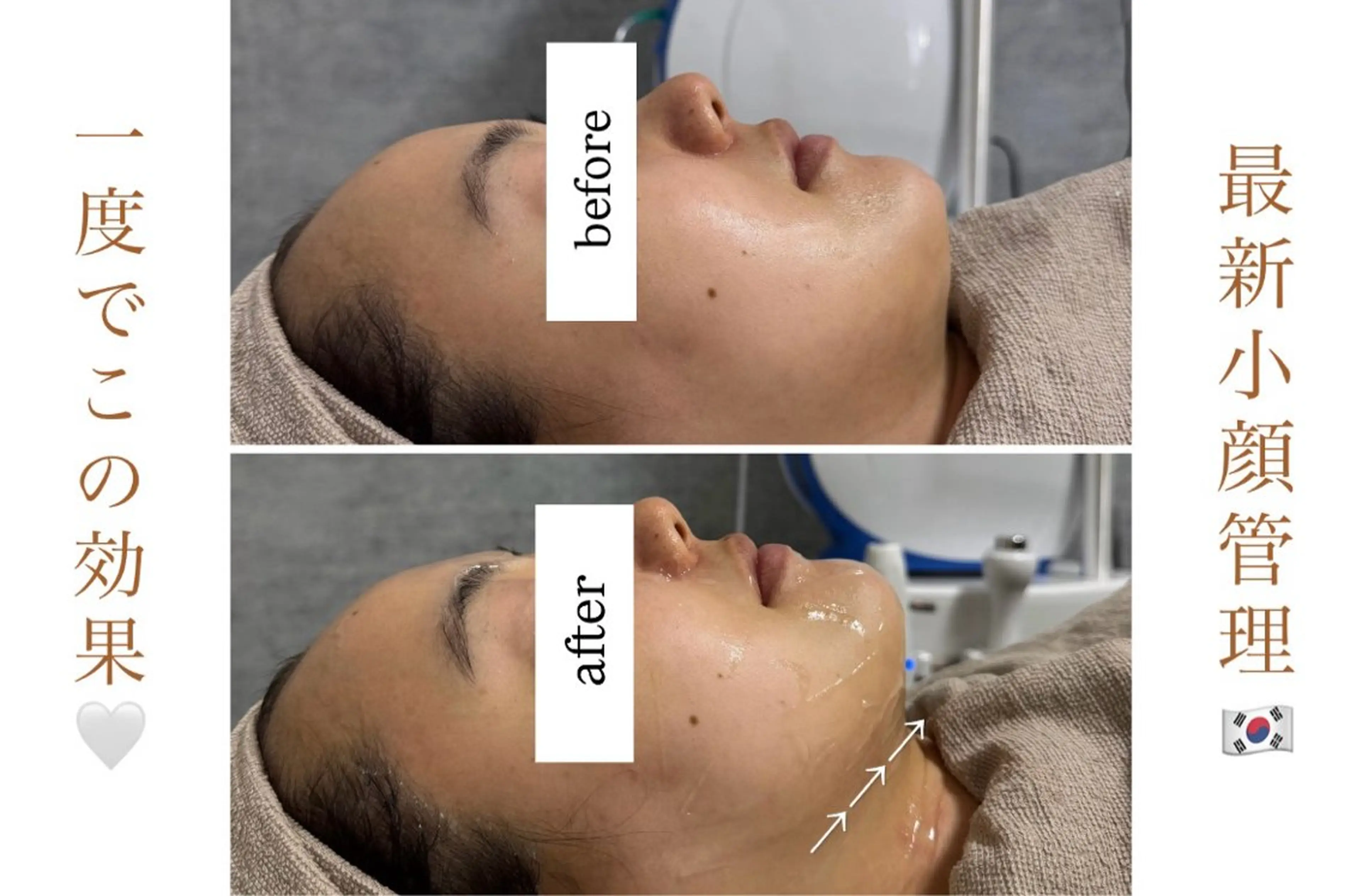 エステ 【韓国肌管理・脱毛】 クレセントのその他イメージ