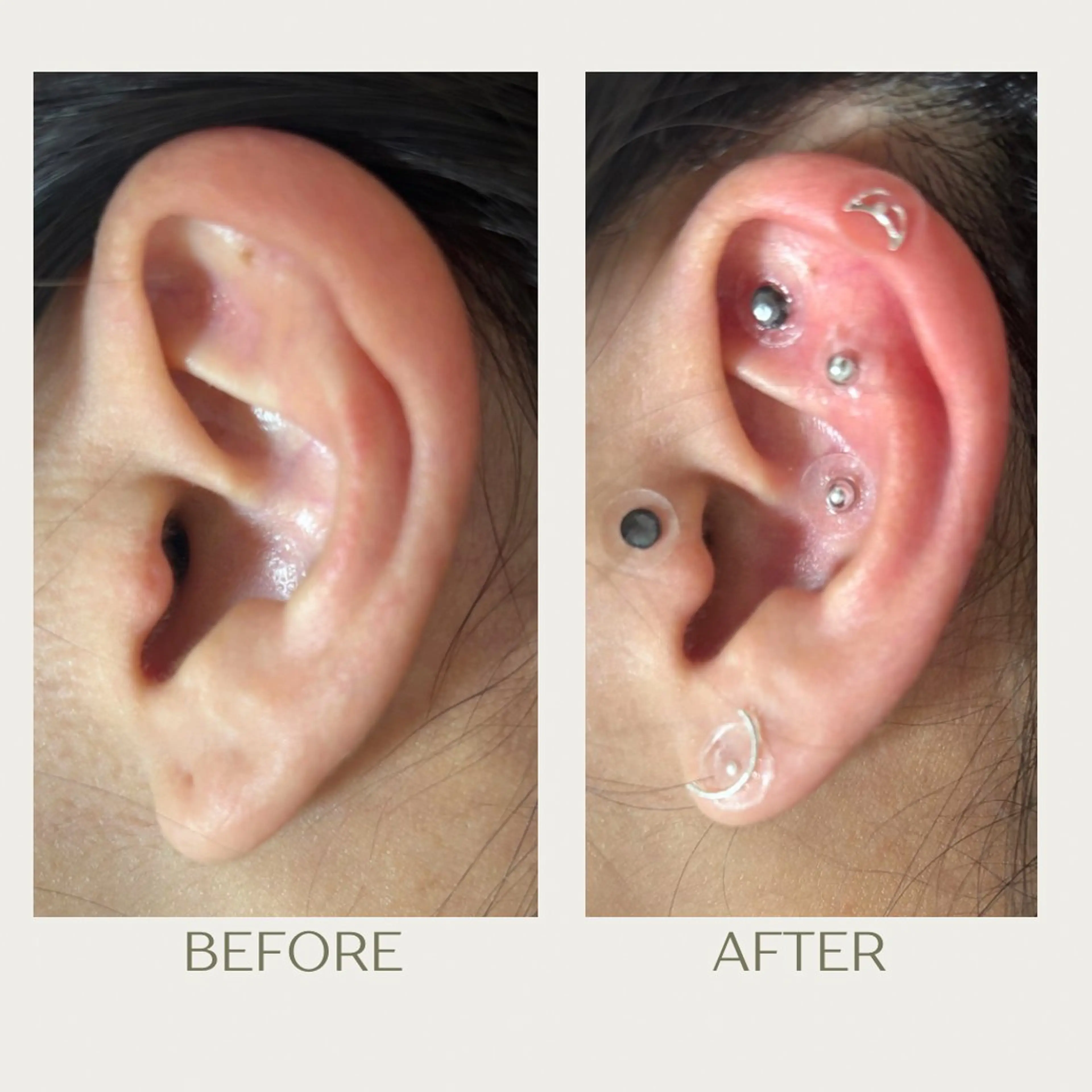 その他 ピーリングケア 🤍moekoのその他イメージ