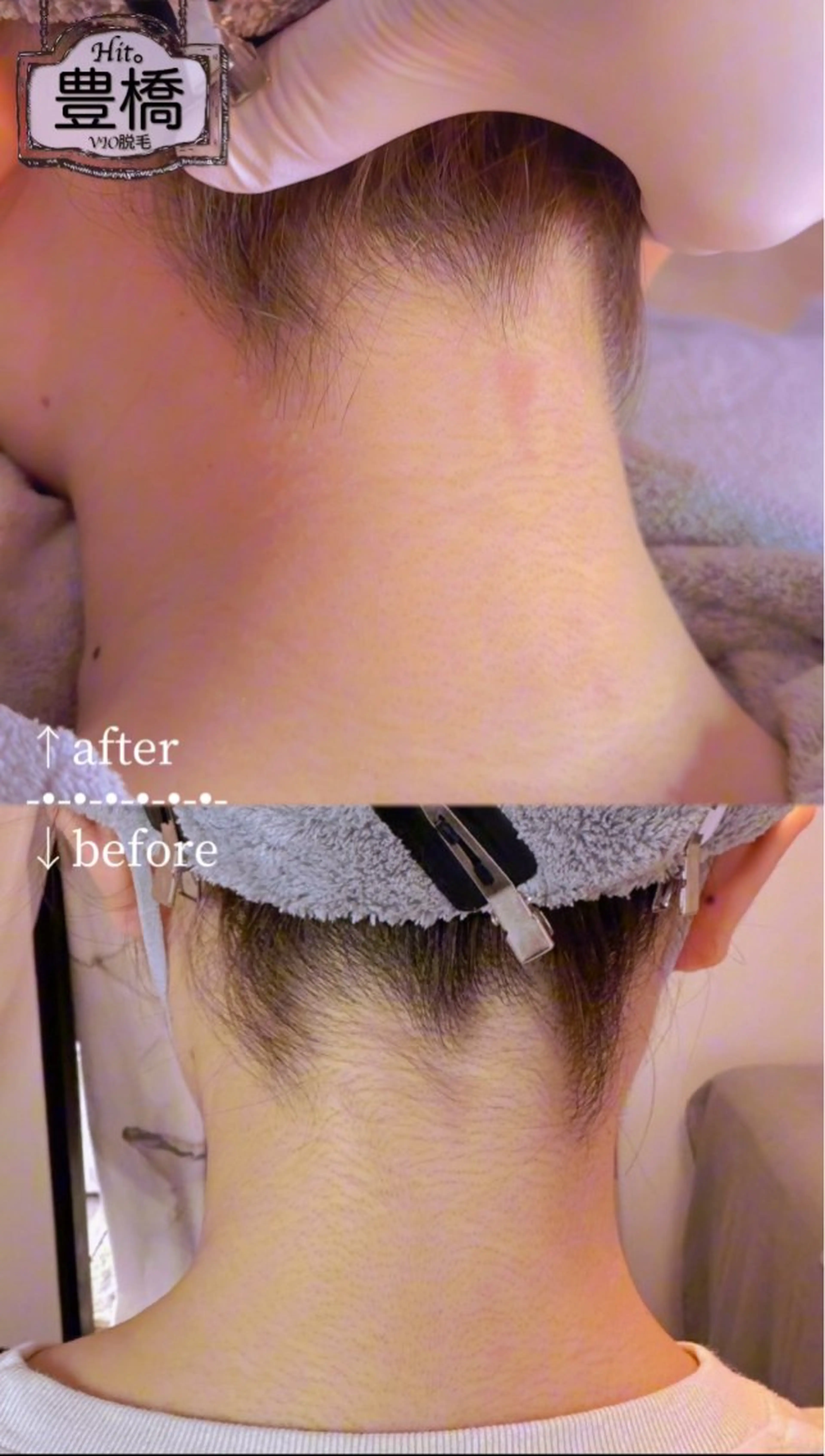 Hitomi シュガーリング豊橋のその他イメージ