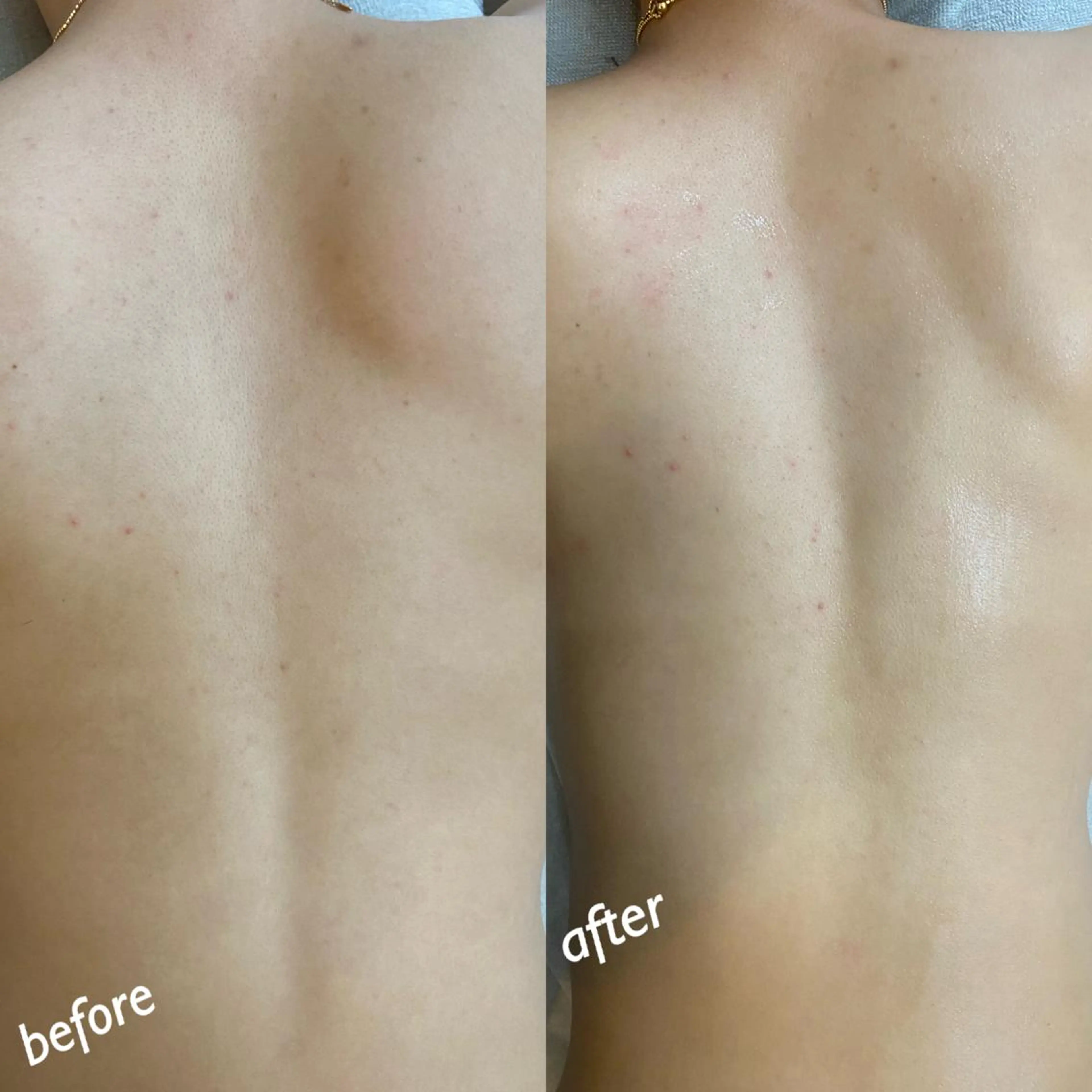 うなじ脱毛/美肌脱毛 LABELのエステ・リラクイメージ