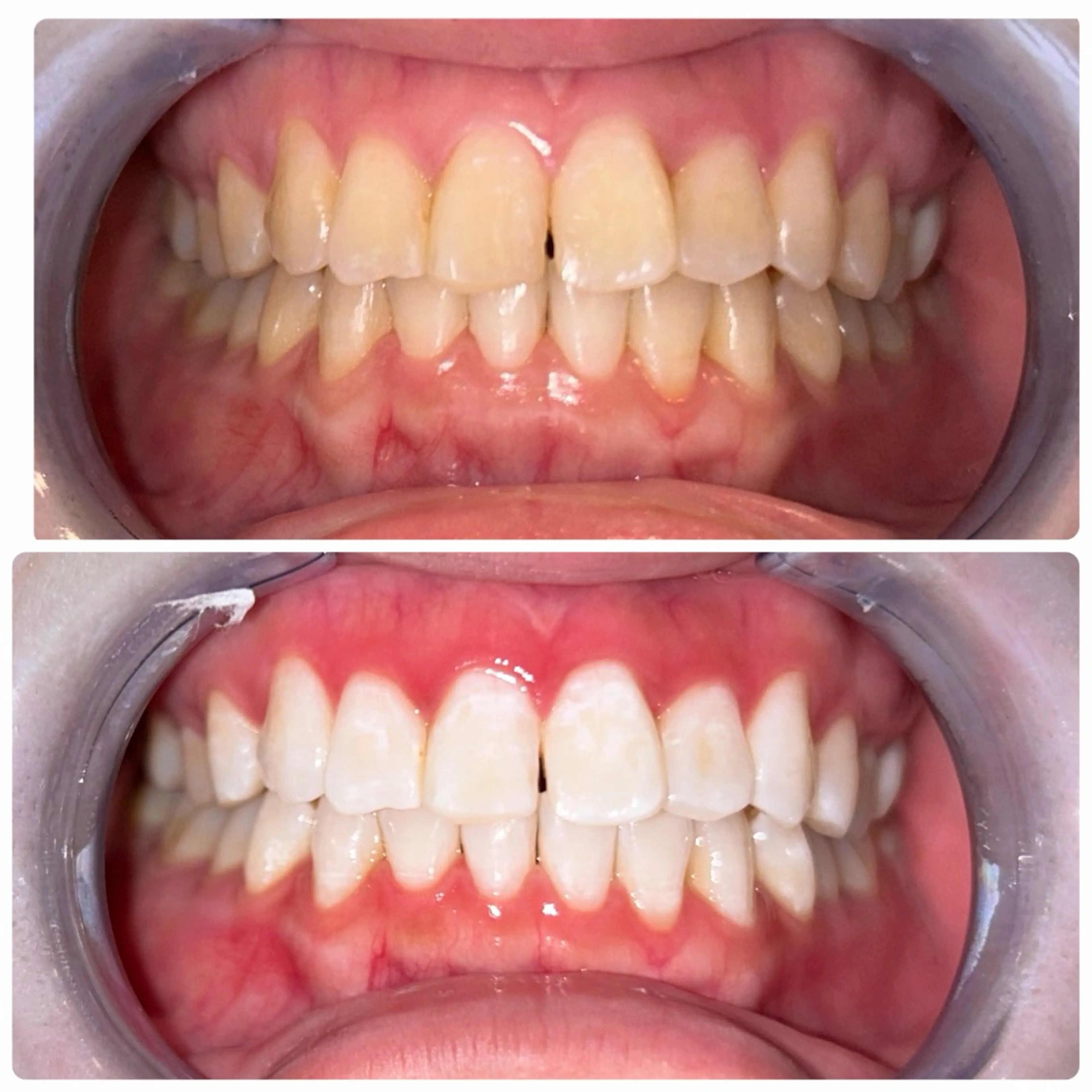 エステ ホワイトニング 神保町店/杉浦のエステ・リラクイメージ