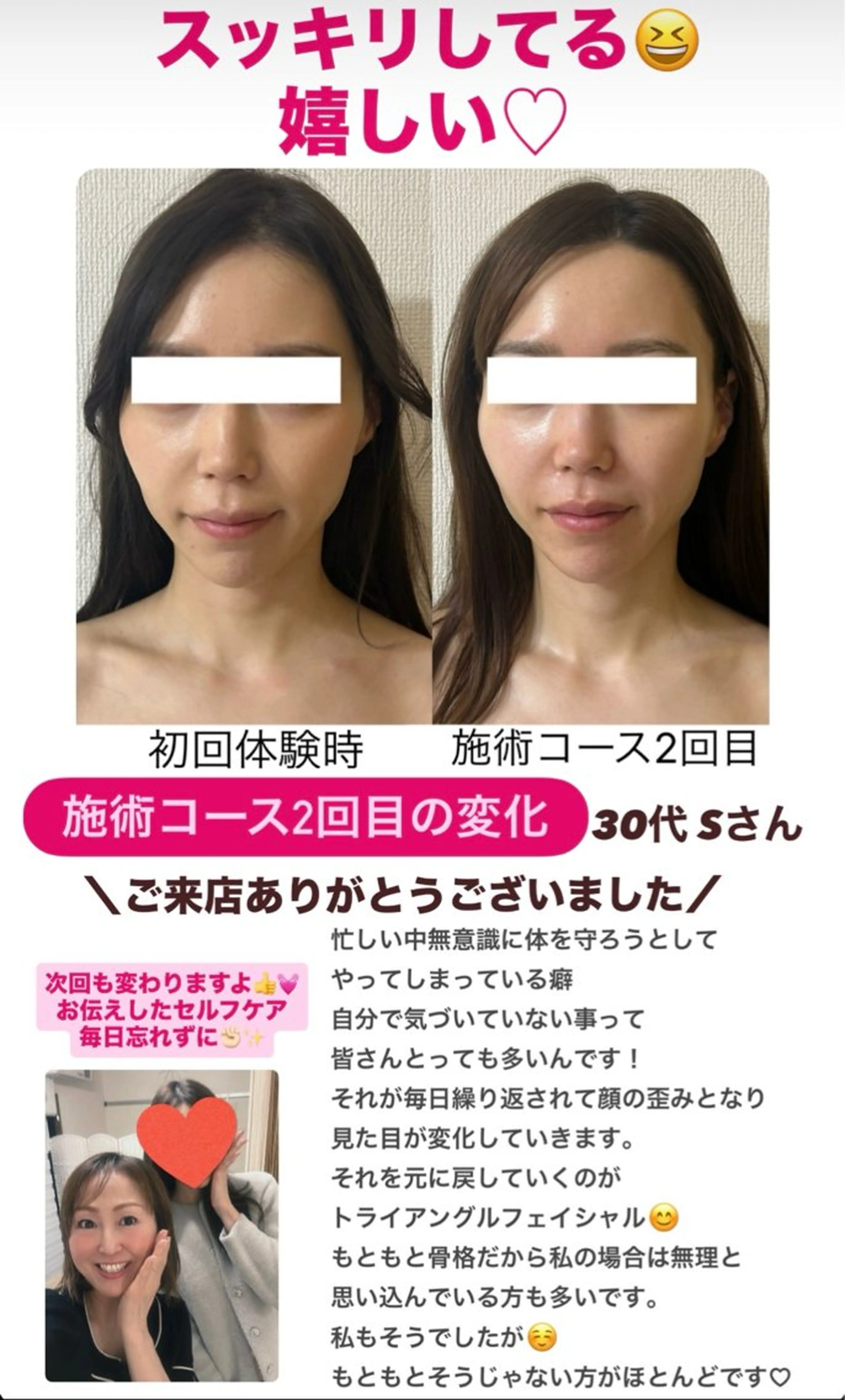 la lumie're (ラ リュミエール)所属・小顔サロン (ラ リュミエール)のエステ・リラクイメージ