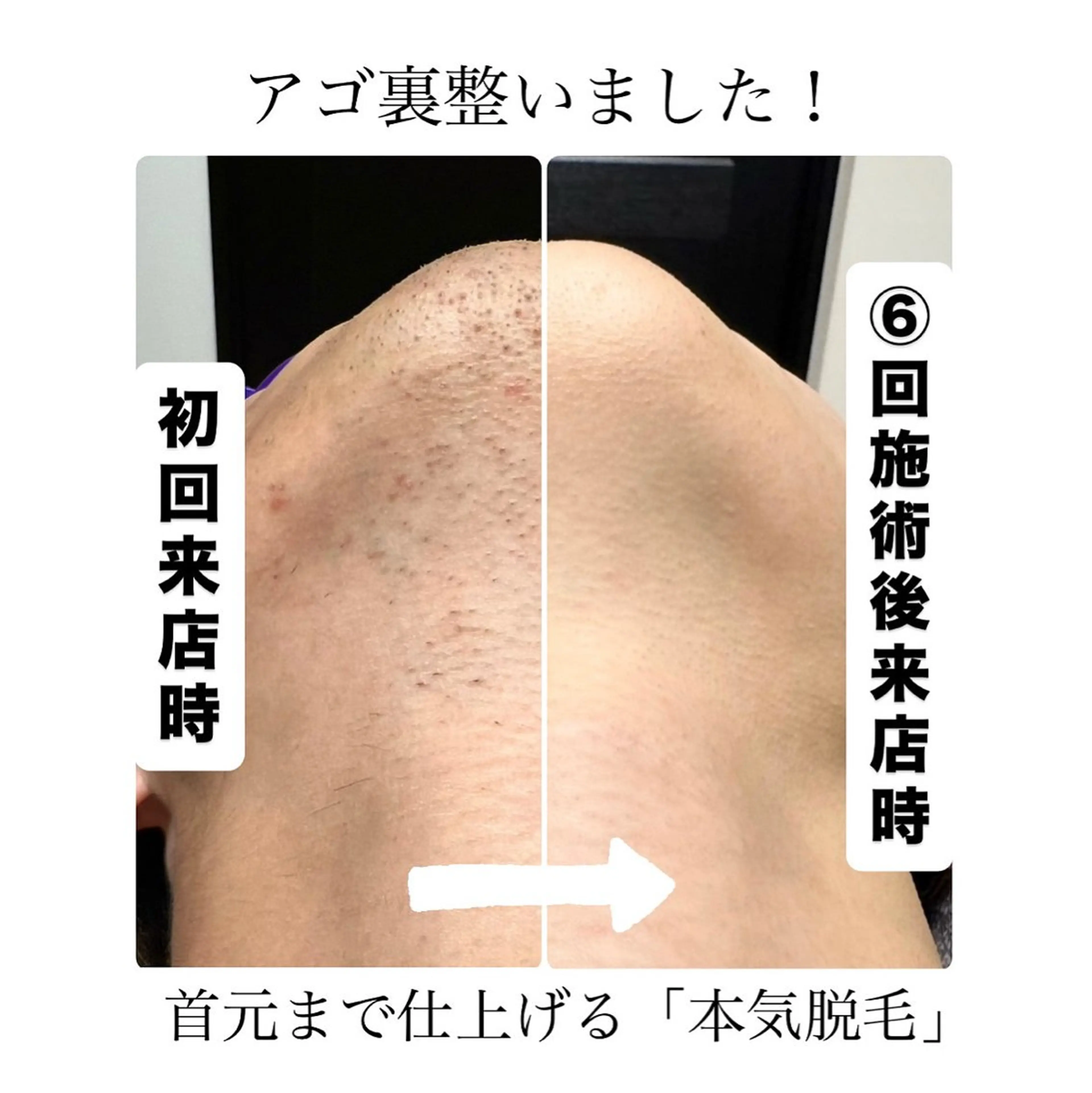 メンズ 脱毛 メンズ脱毛サロン Le falcoのエステ・リラクイメージ