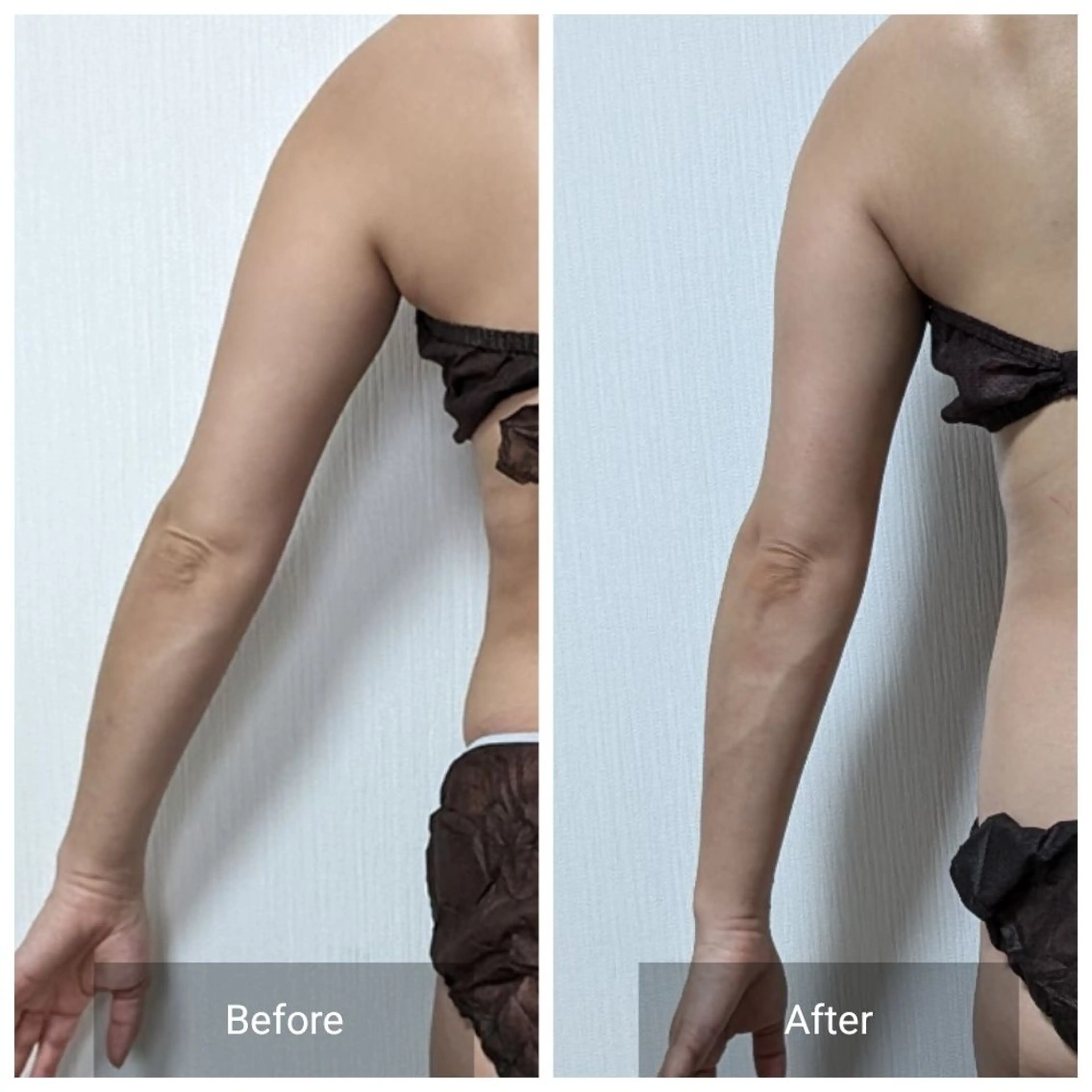 ミニモ限定!短時間でほっそり二の腕集中!!お写真提供可能な方の写真