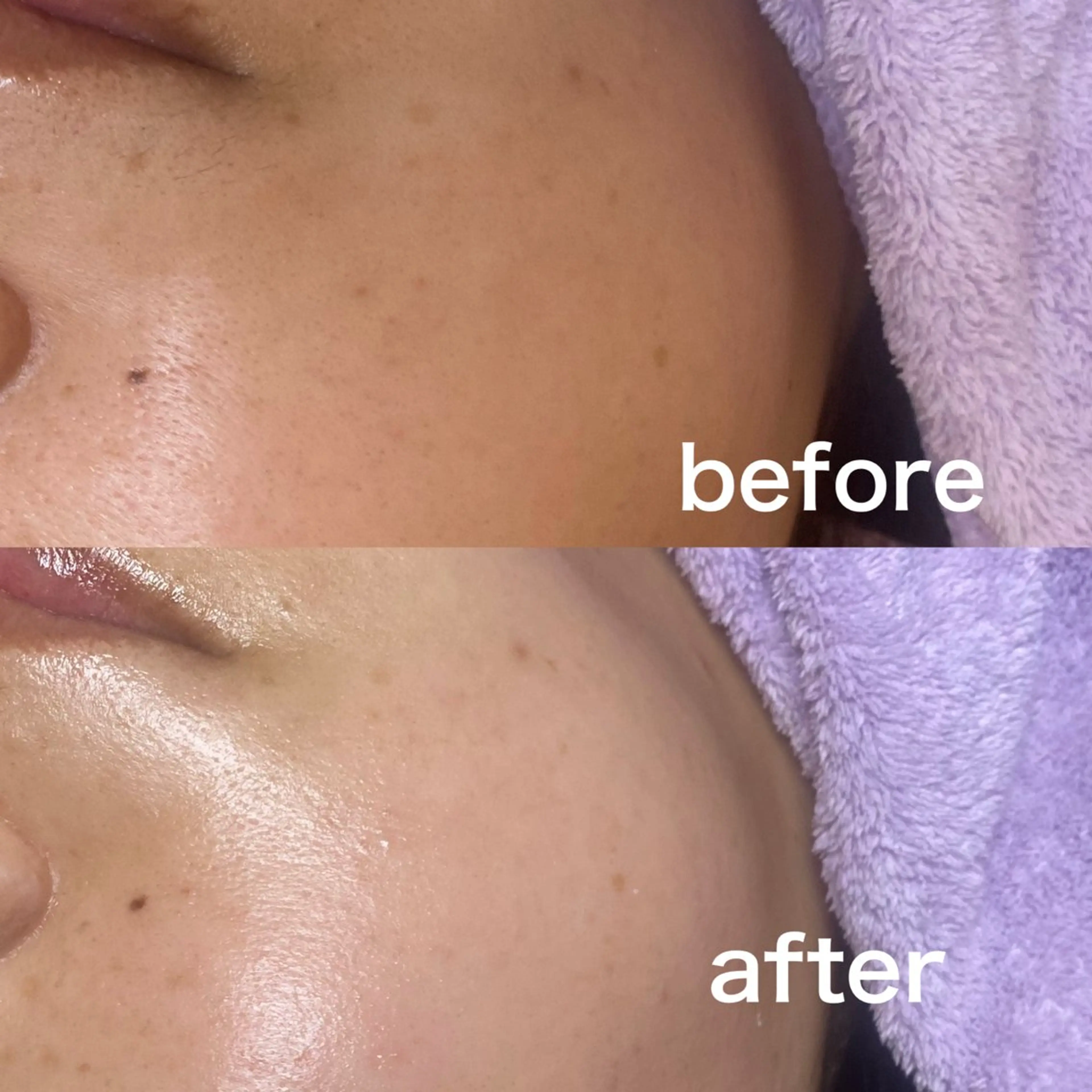 まつげと艶肌♪垢抜けメニュー LEDエク100本orまつげパーマフラット内側から発光するお肌へ～フェイスワックス～の写真