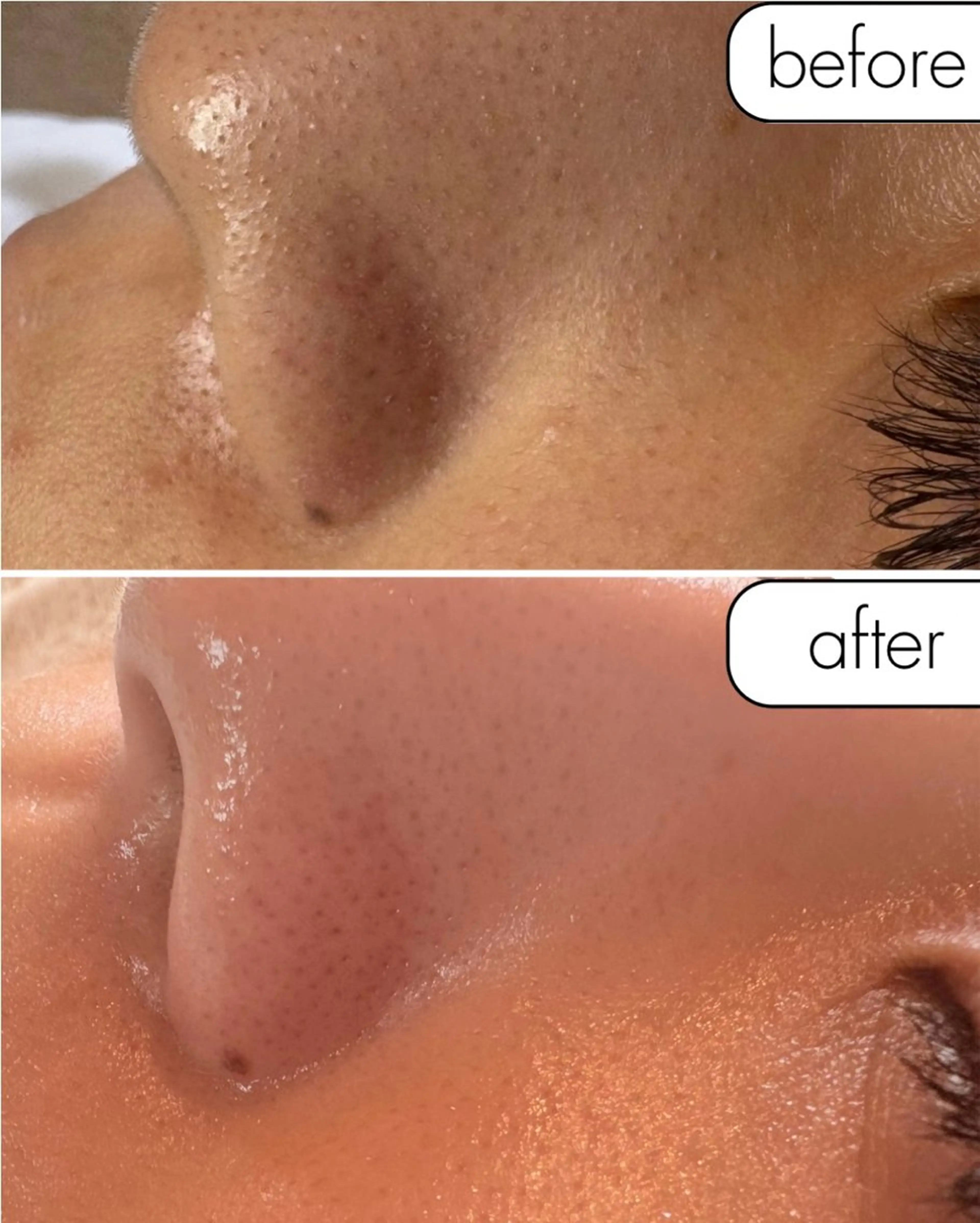 脱毛 糸除毛専門salon acoのエステ・リラクイメージ