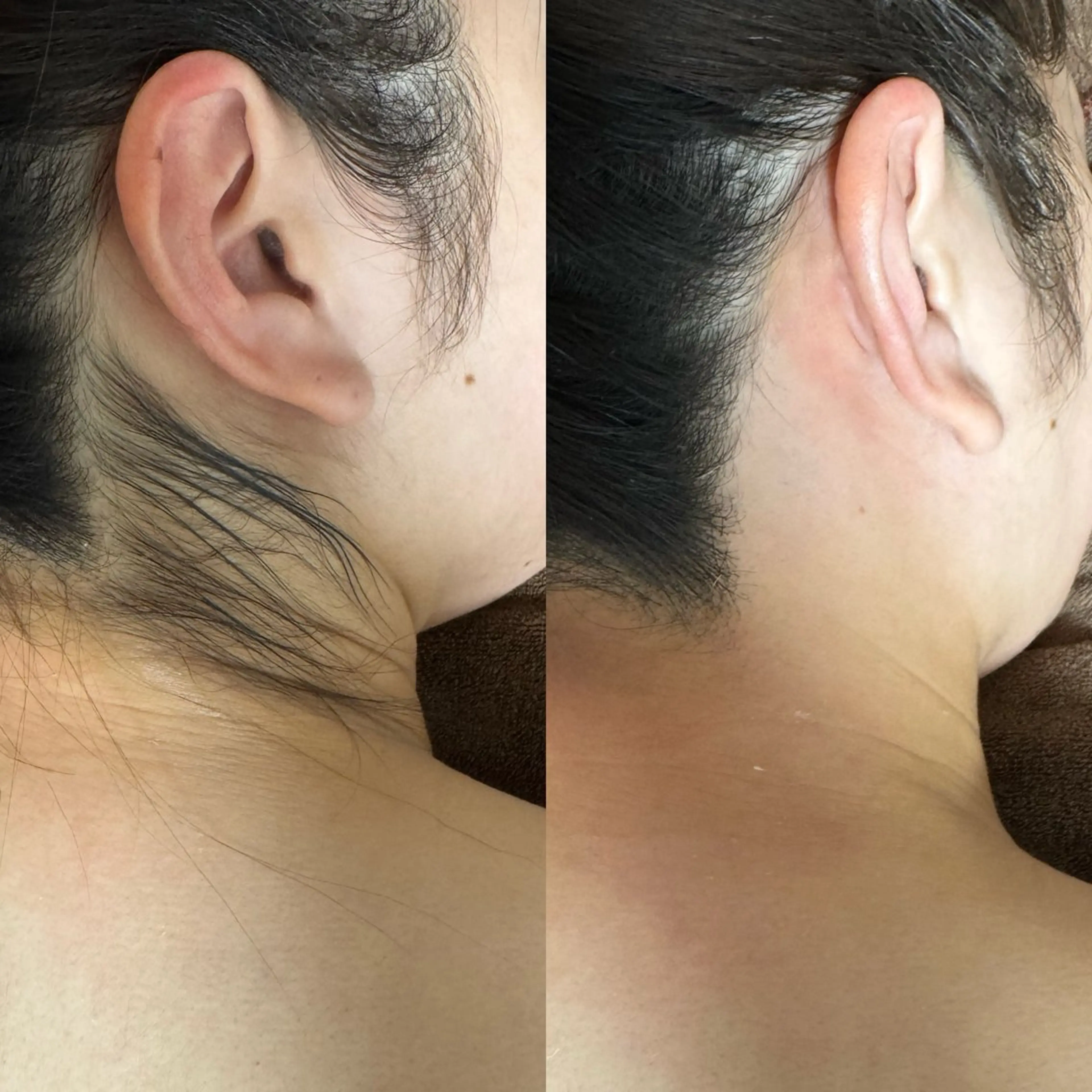 脱毛 六本木脱毛andS 店長Sachiのエステ・リラクイメージ