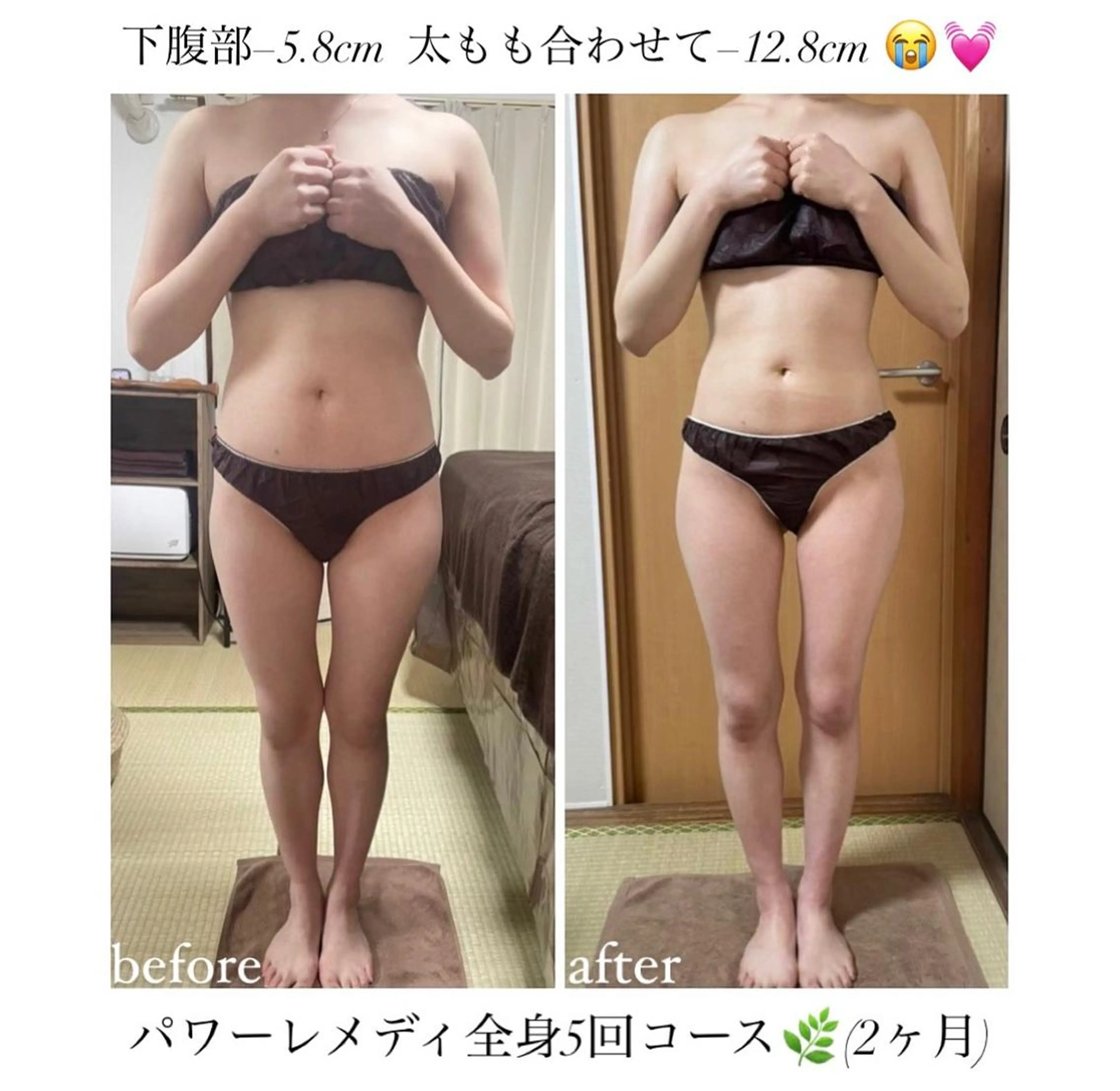《本気痩せ×疲労改善 》  BILOOPのエステ・リラクイメージ