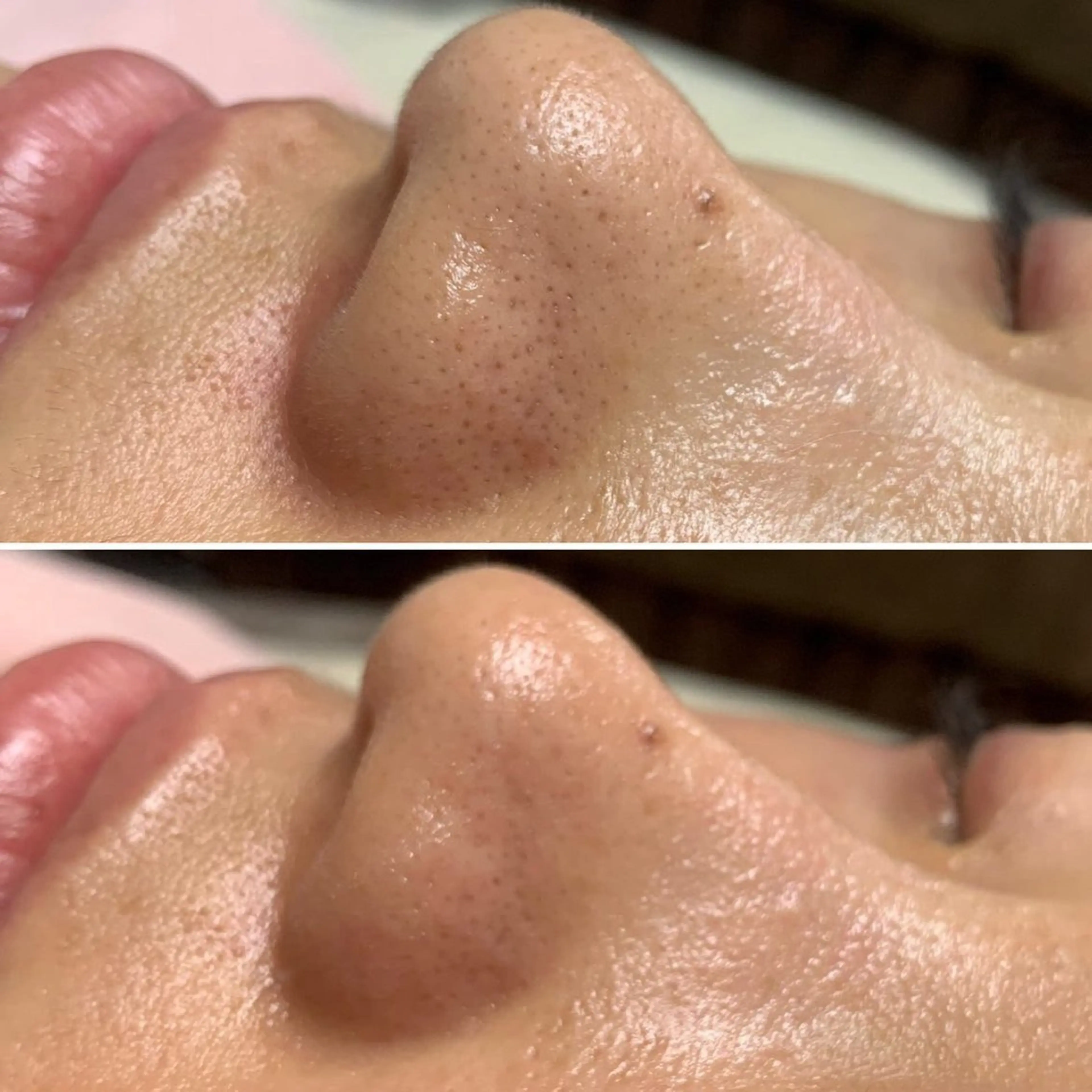 韓国艶美人// 毛穴ケア🌹のエステ・リラクイメージ