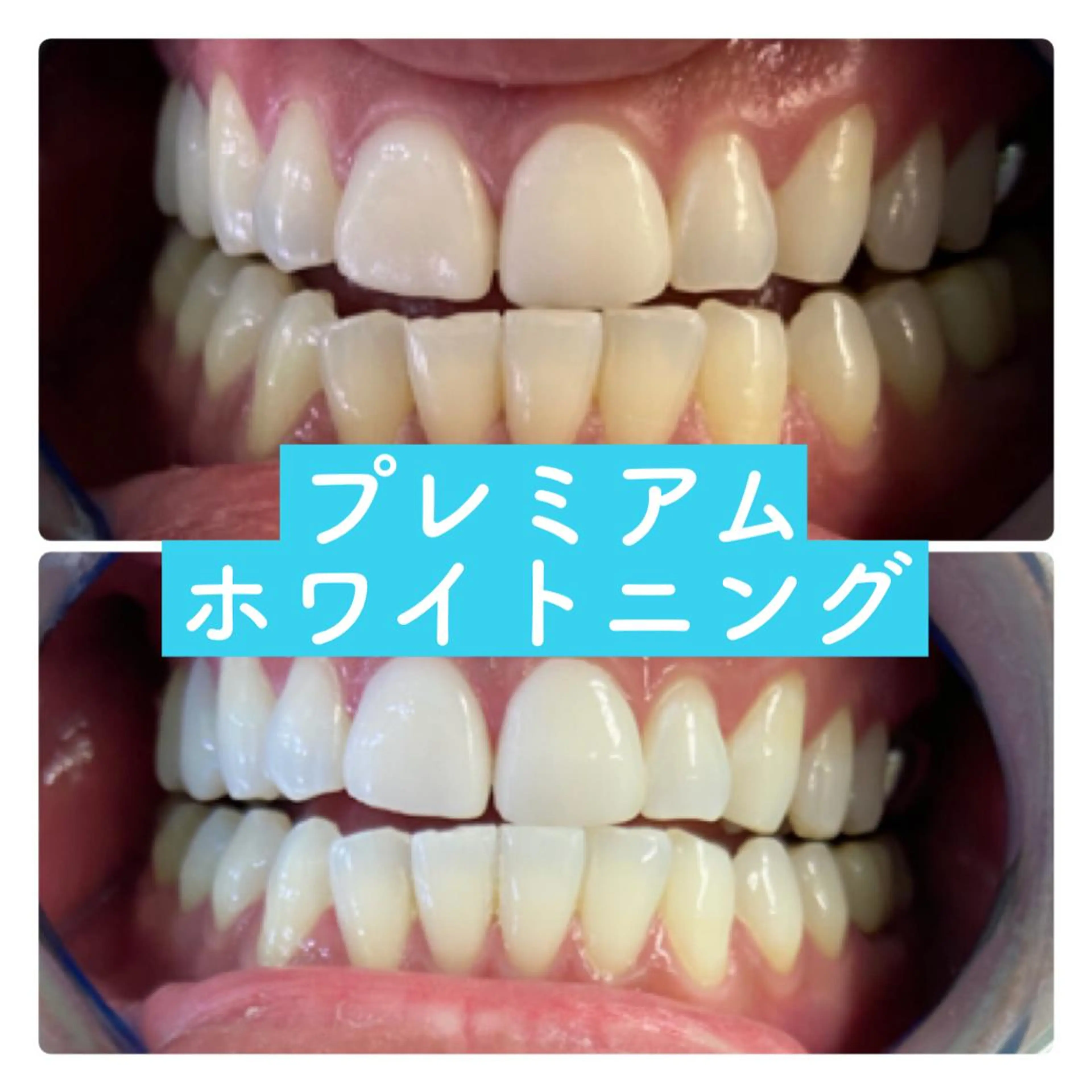 ホワイトニングルーム 横浜店のその他イメージ