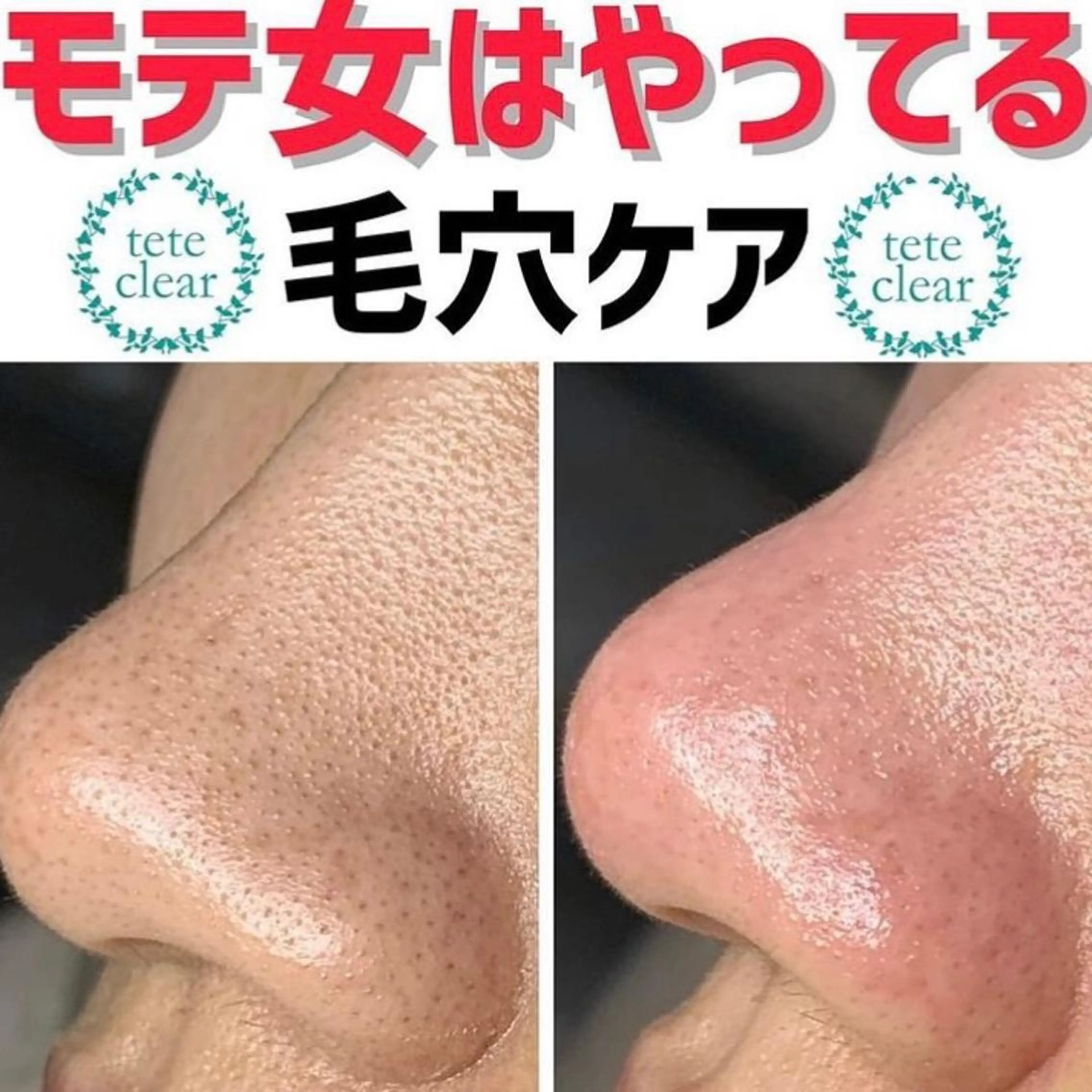 毛穴肌質ケアサロン Yourmeユアミーのエステ・リラクイメージ