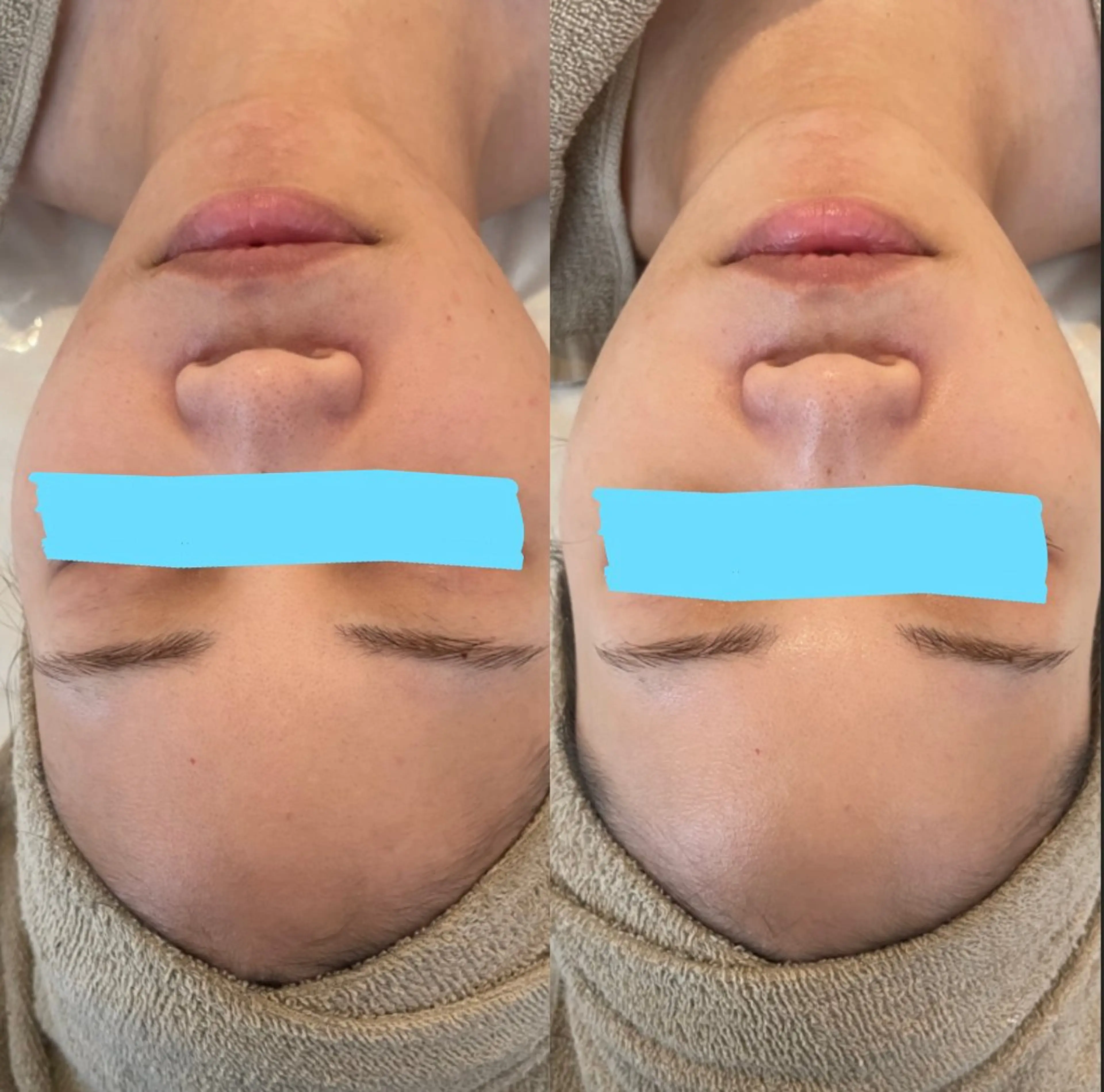 中目黒ハーブピーリン グ🌿ララピールのエステ・リラクイメージ