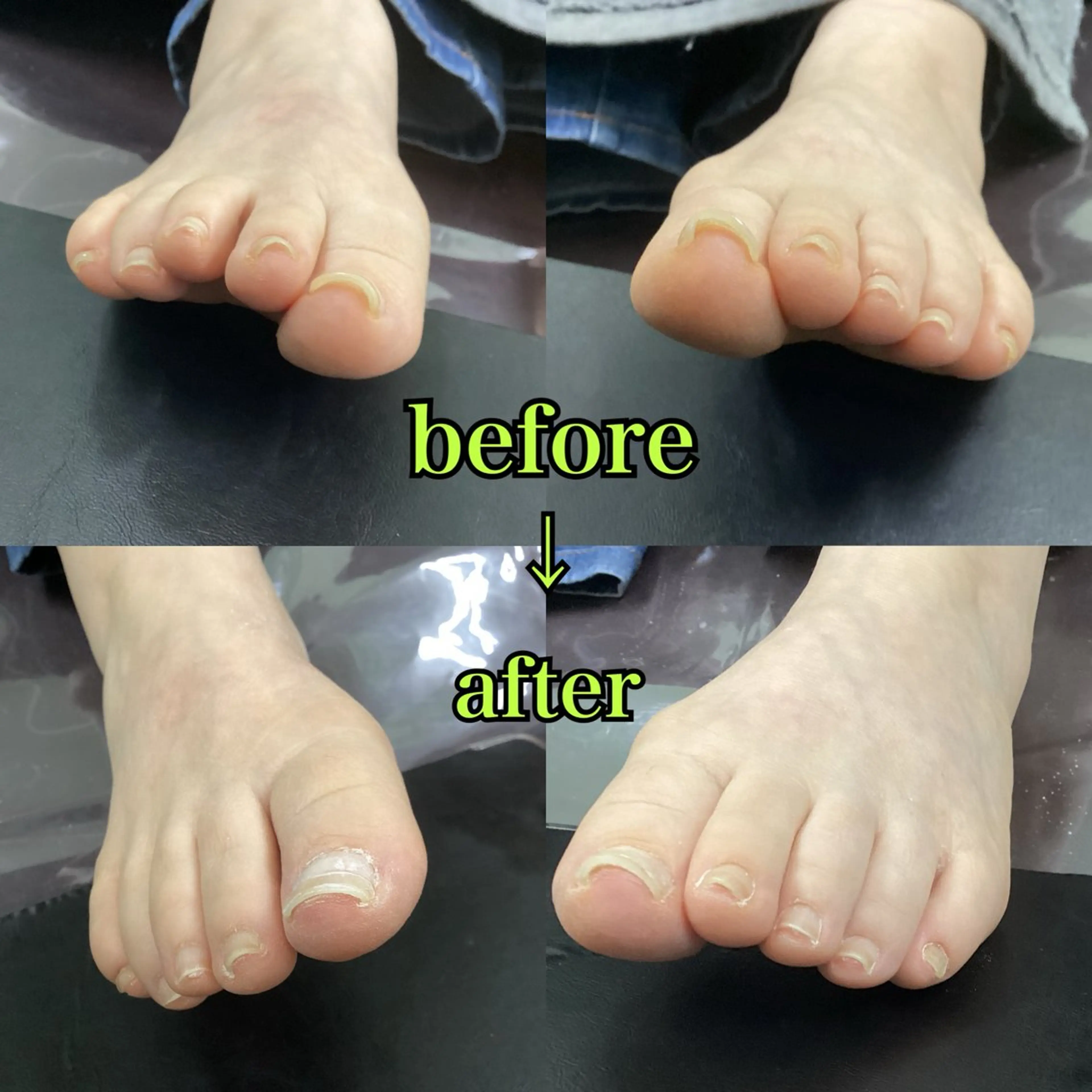 ネイル フットネイル リラク/ネイル/ 足裏ケア/蛭川栞のエステ・リラクイメージ