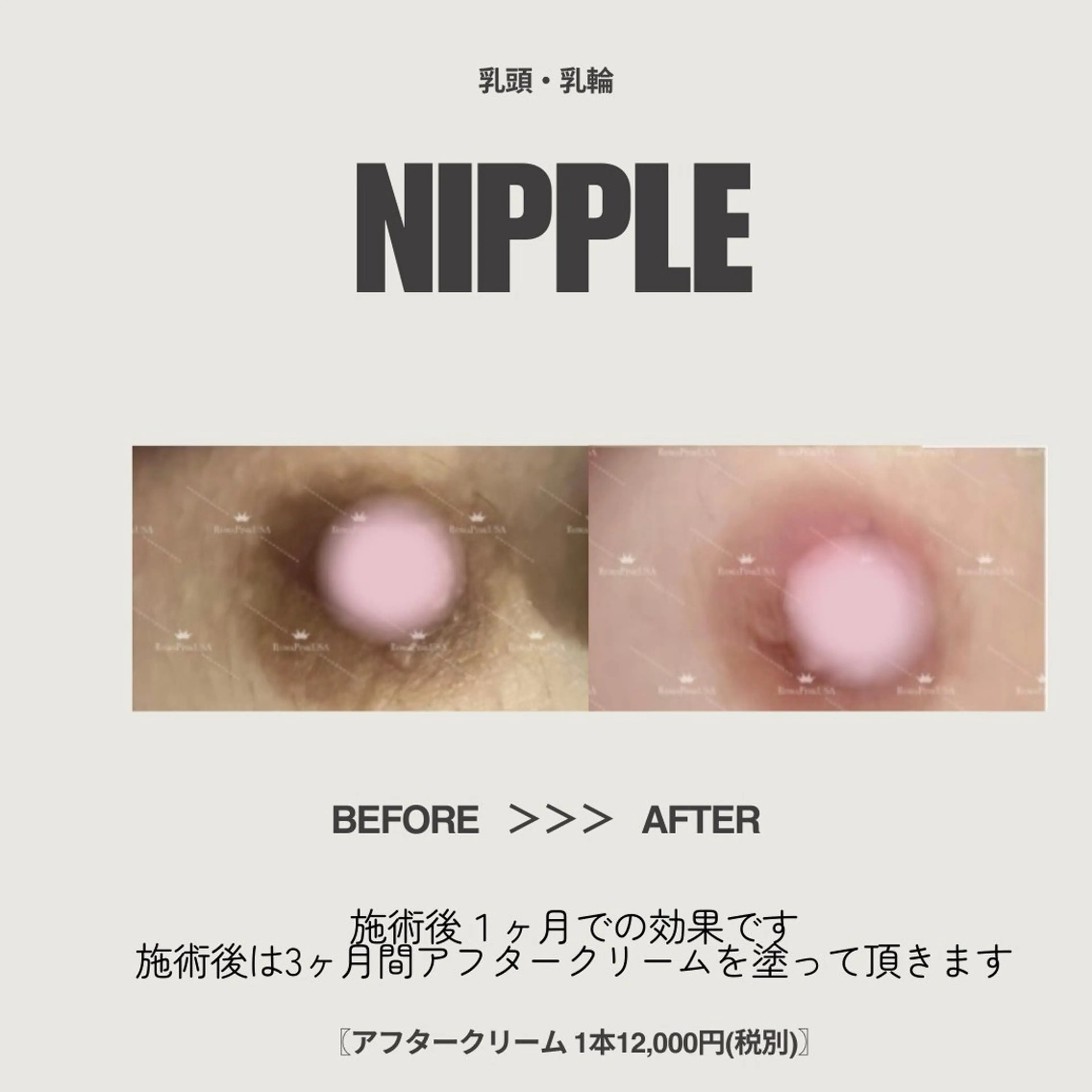 ROMA PINK 乳輪·乳頭モニター定価より40%OFFの写真