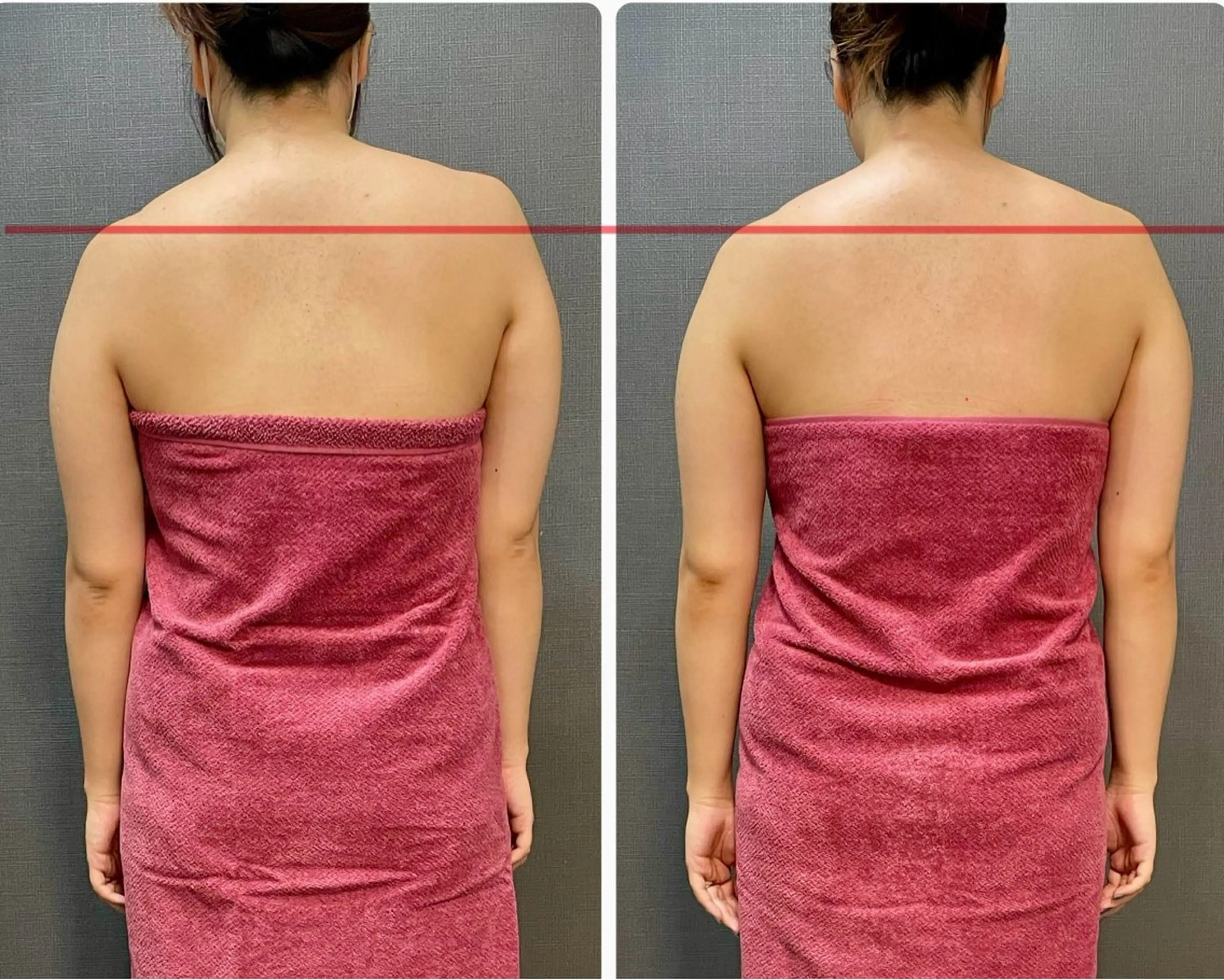 【代謝×免疫UP】お肌と身体のオールハンド専門店estheya sign所属・深層筋×筋膜リリース 首肩こり/むくみのエステ・リラクイメージ