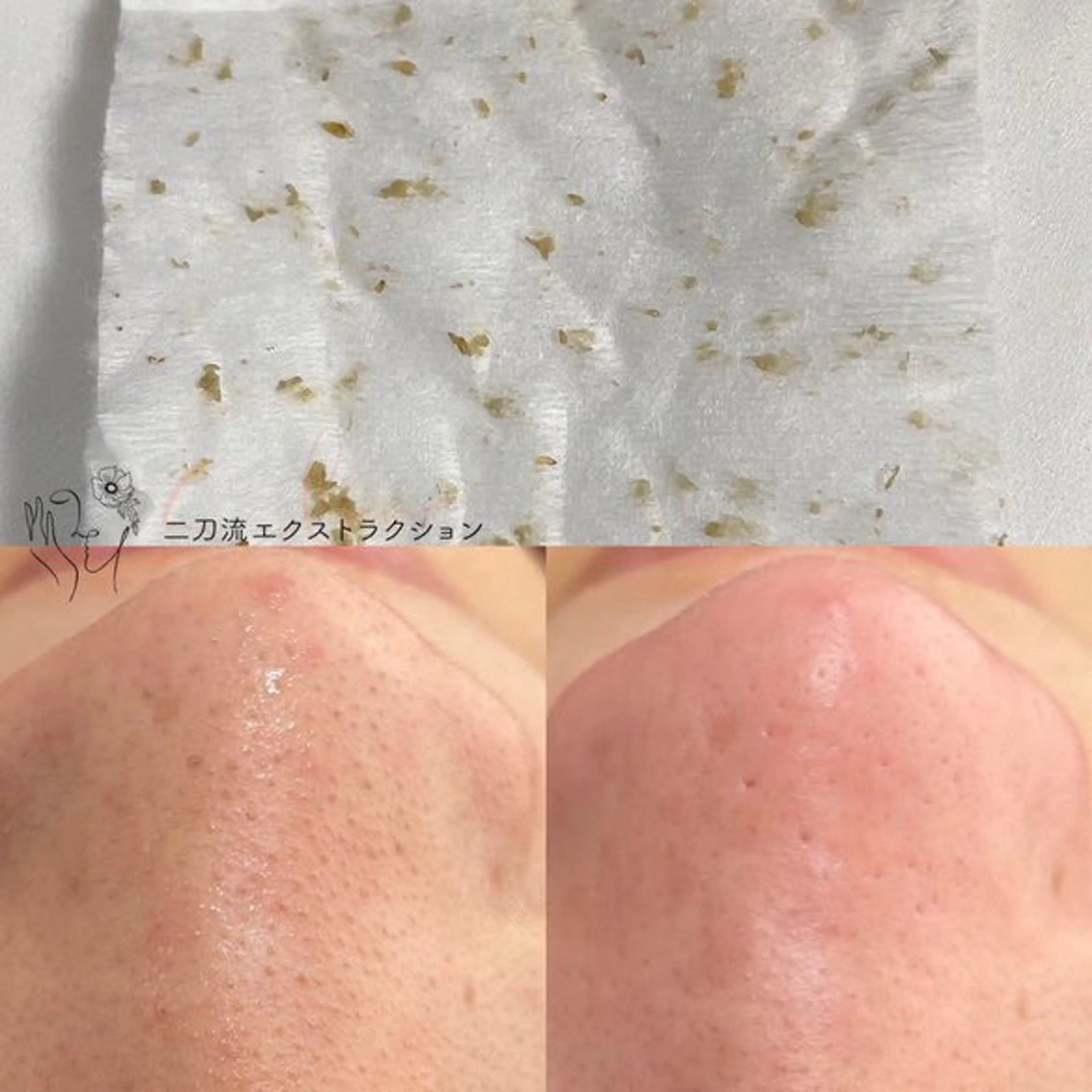 エステ Le'perle。所属・Le'perle。 Kyokaのエステ・リラクイメージ