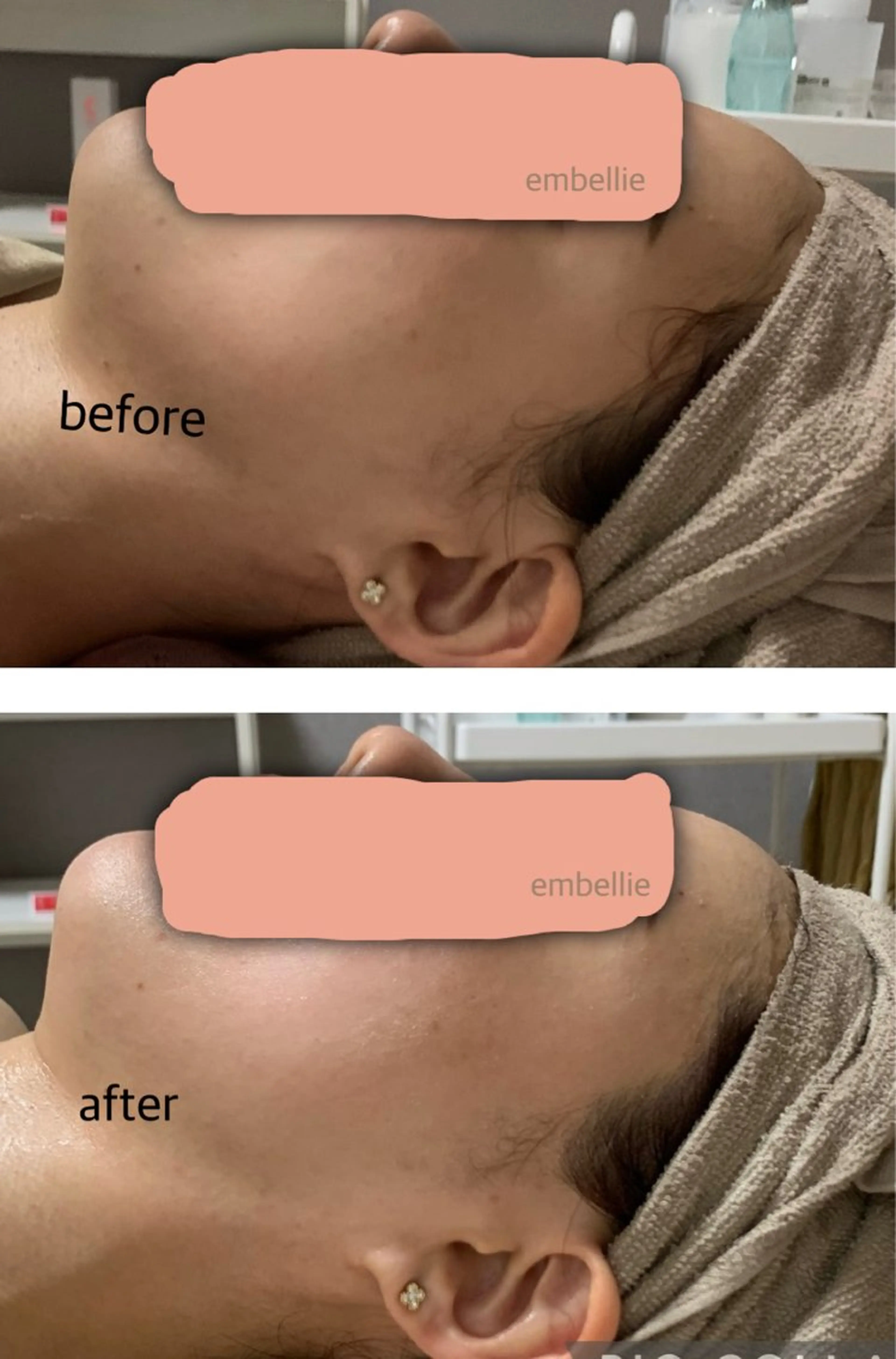 エステ miyasaka erikoのネイルデザイン