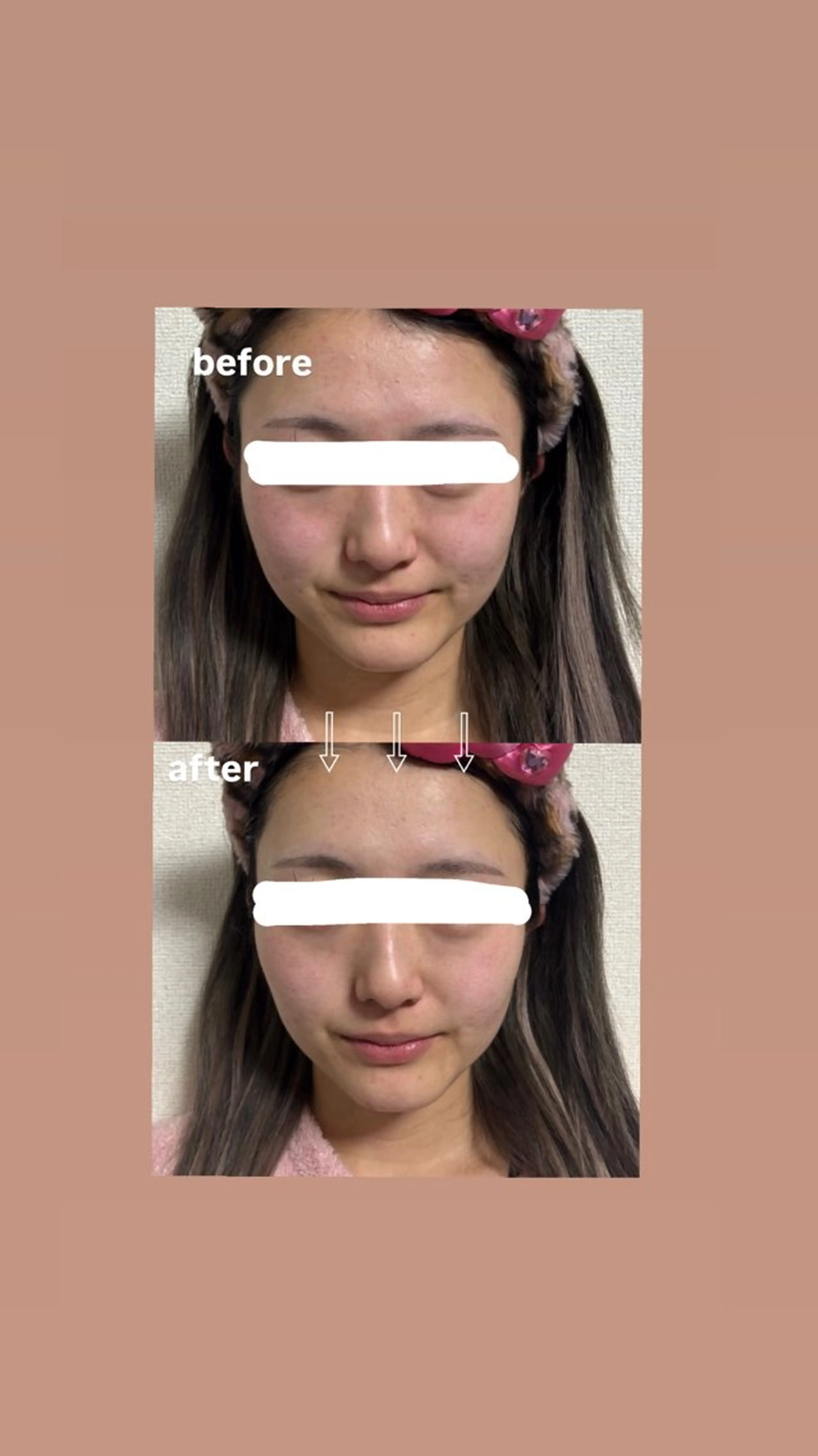 エステ 「EARTH夢咲店」 前田のその他イメージ