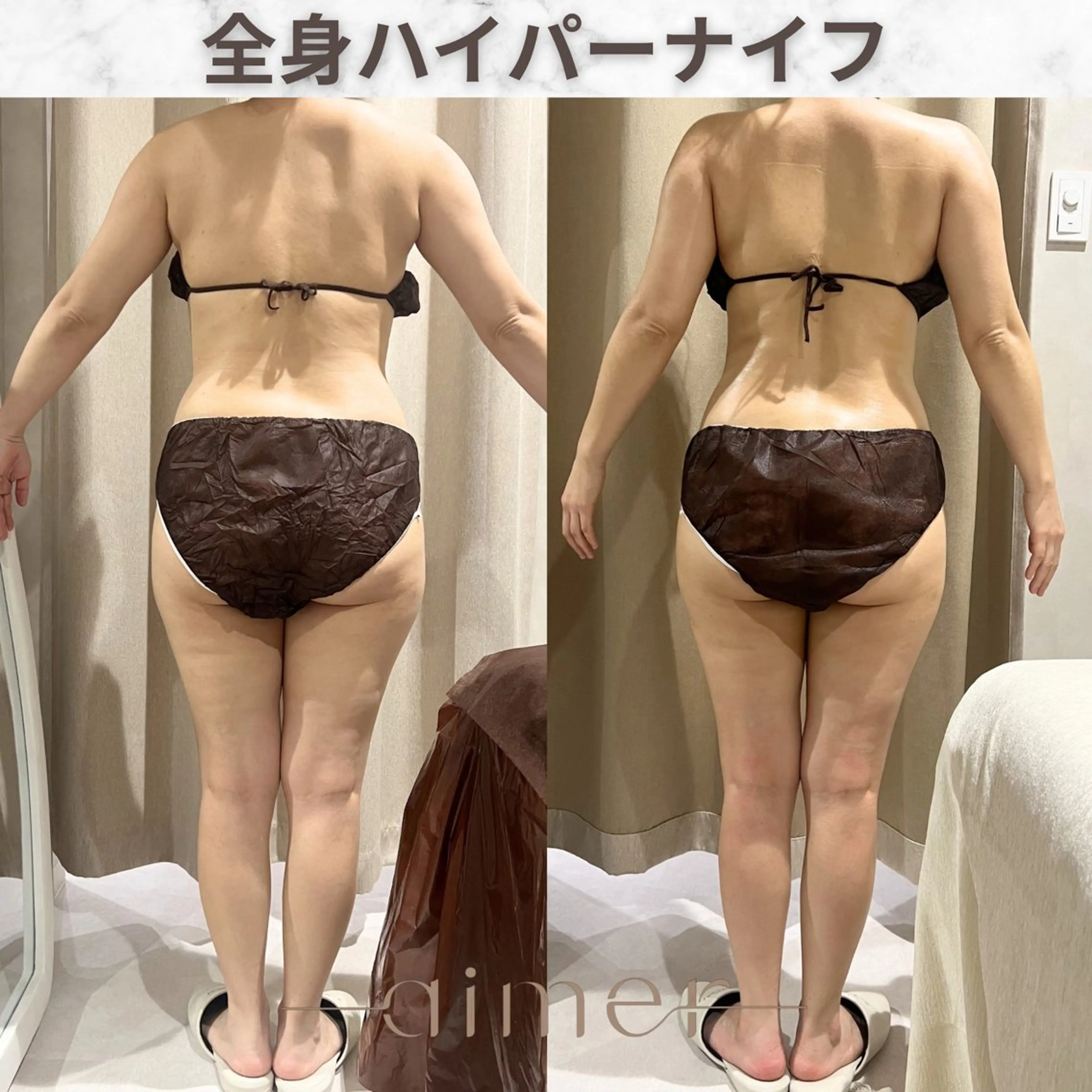 エステ aimer服部 /  小顔 ・ 痩身のその他イメージ