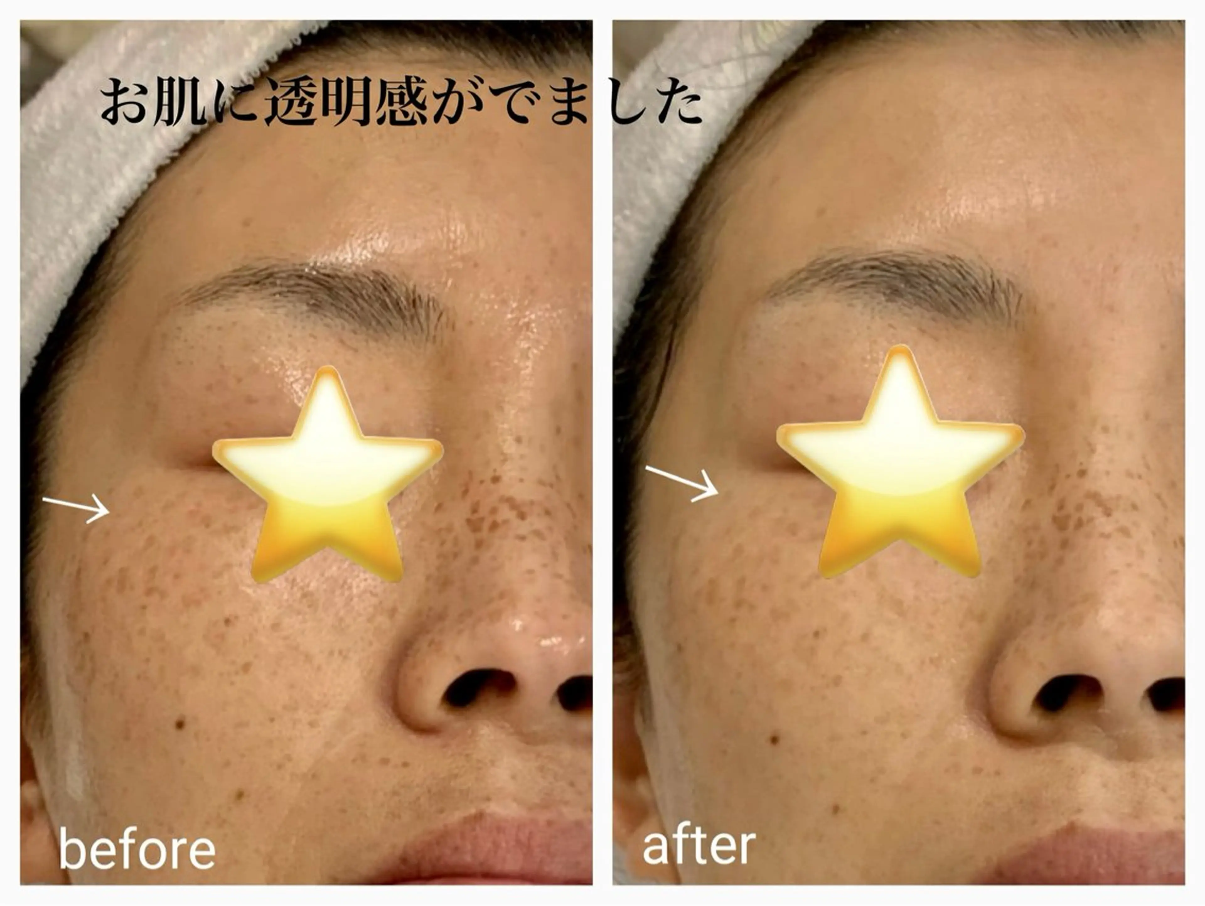 エステ Freesia total beauty所属・熊谷 かおりのエステ・リラクイメージ