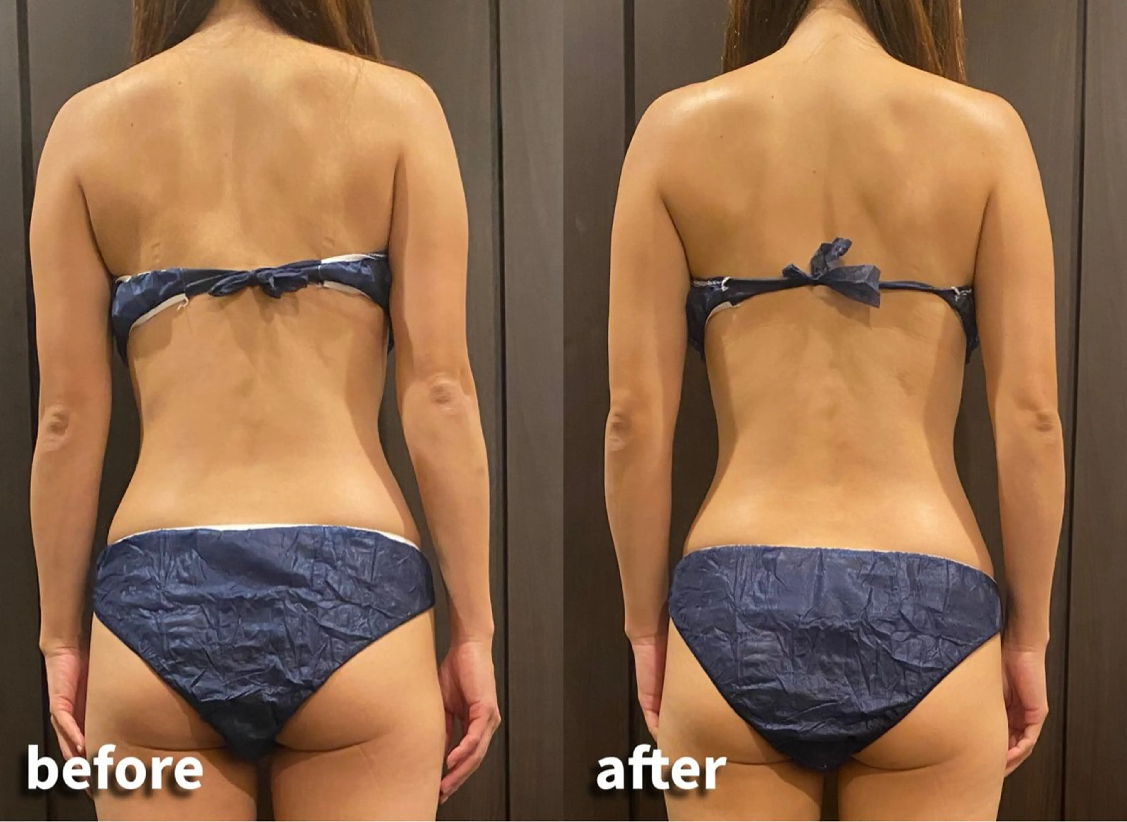 エステ リラク 美u•p 鶴ヶ峰店のマツエク・マツパデザイン