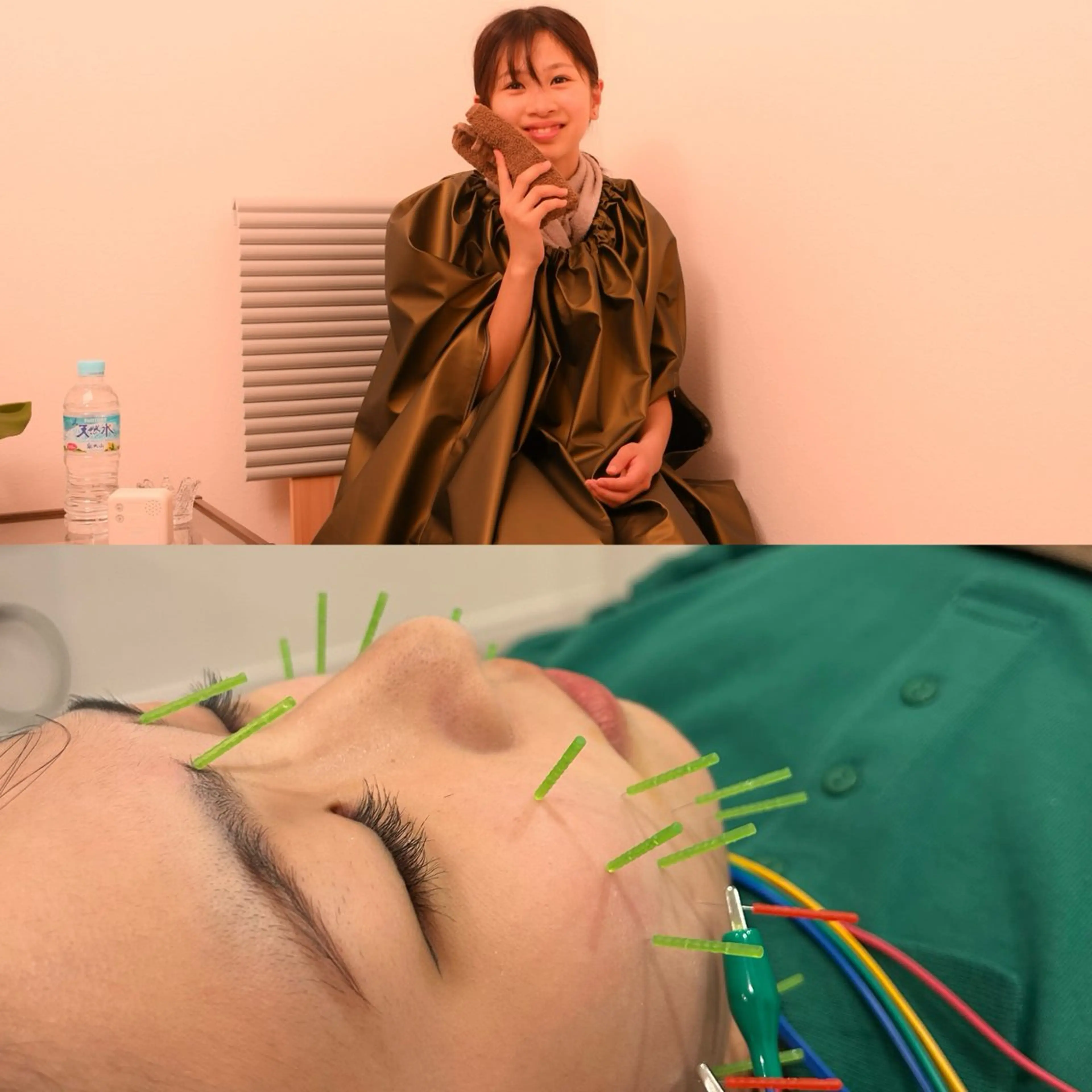 【よもぎ蒸し➕美容鍼】黄土よもぎ蒸し40分+美容鍼+小顔矯正の写真