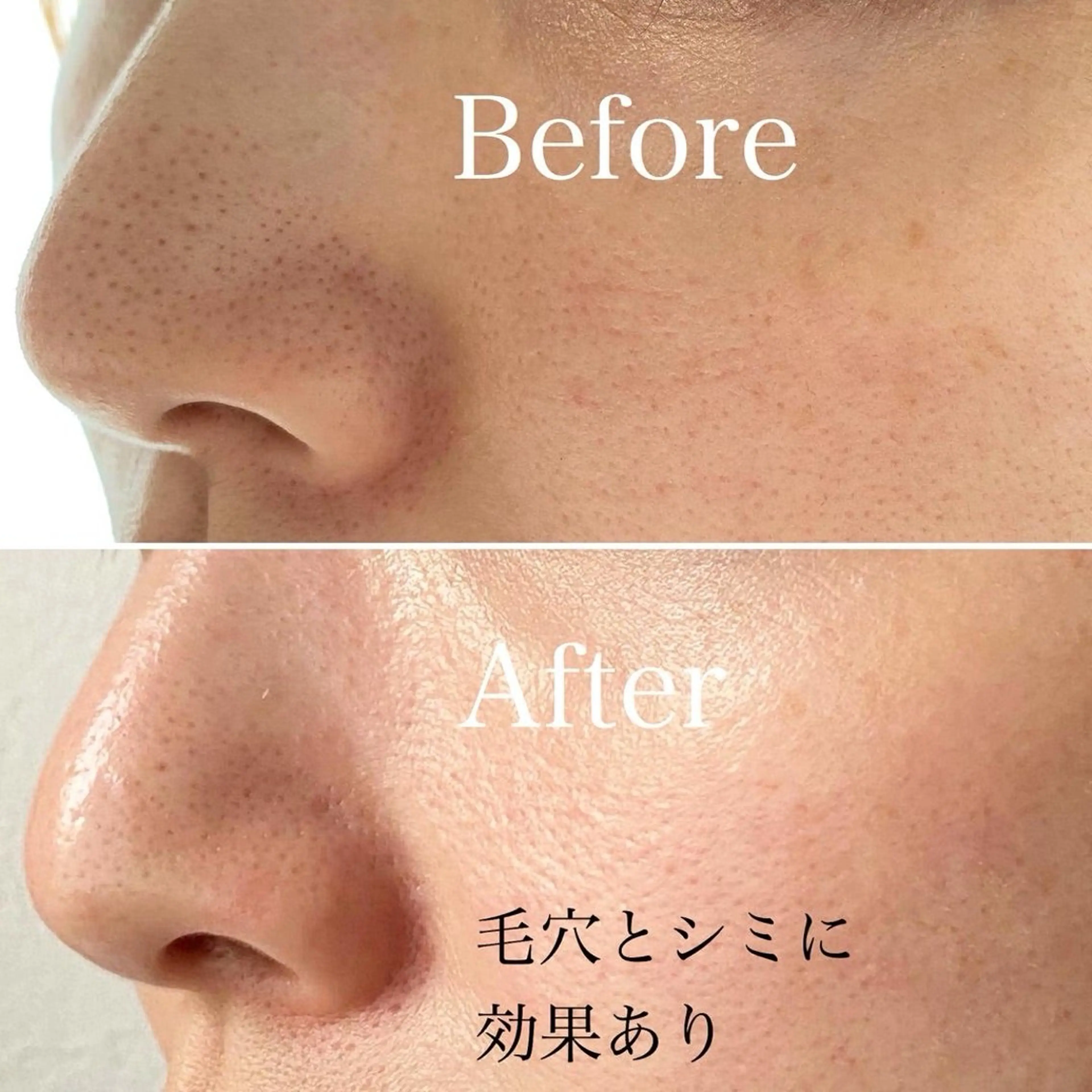 エステ ハーブピーリング専門 毛穴洗浄❤️眉waxのエステ・リラクイメージ