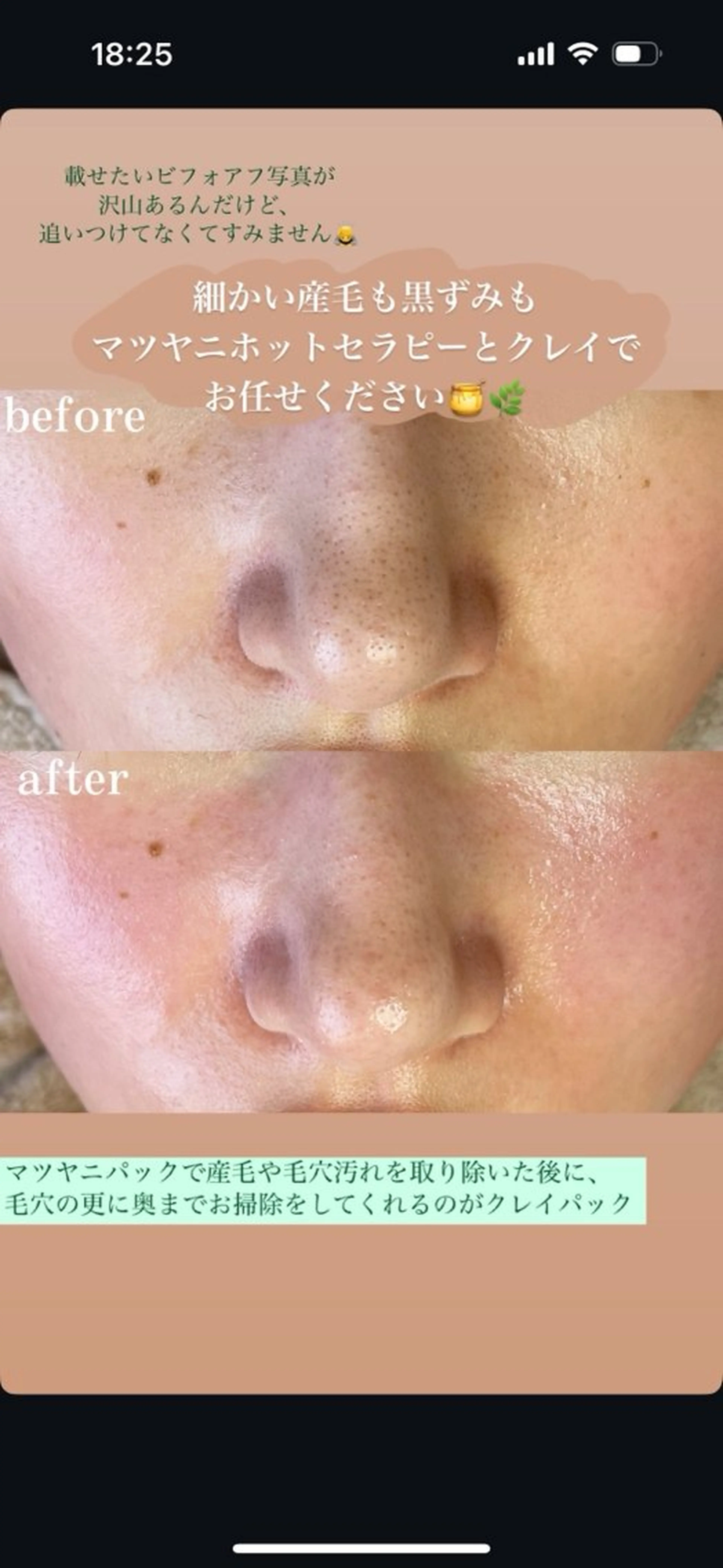 nature  s oin ICHIKAのエステ・リラクイメージ