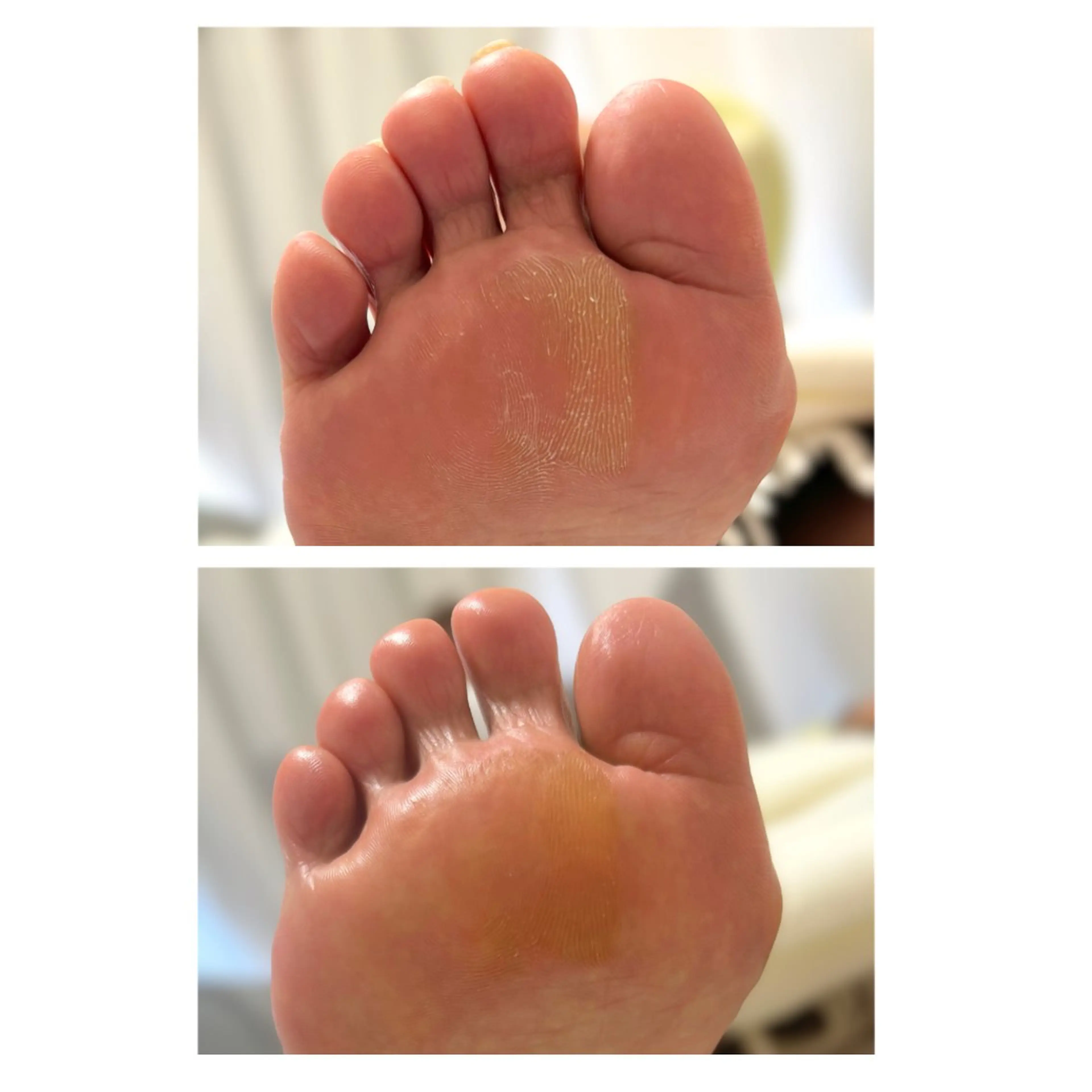 その他 なが さきのネイルデザイン