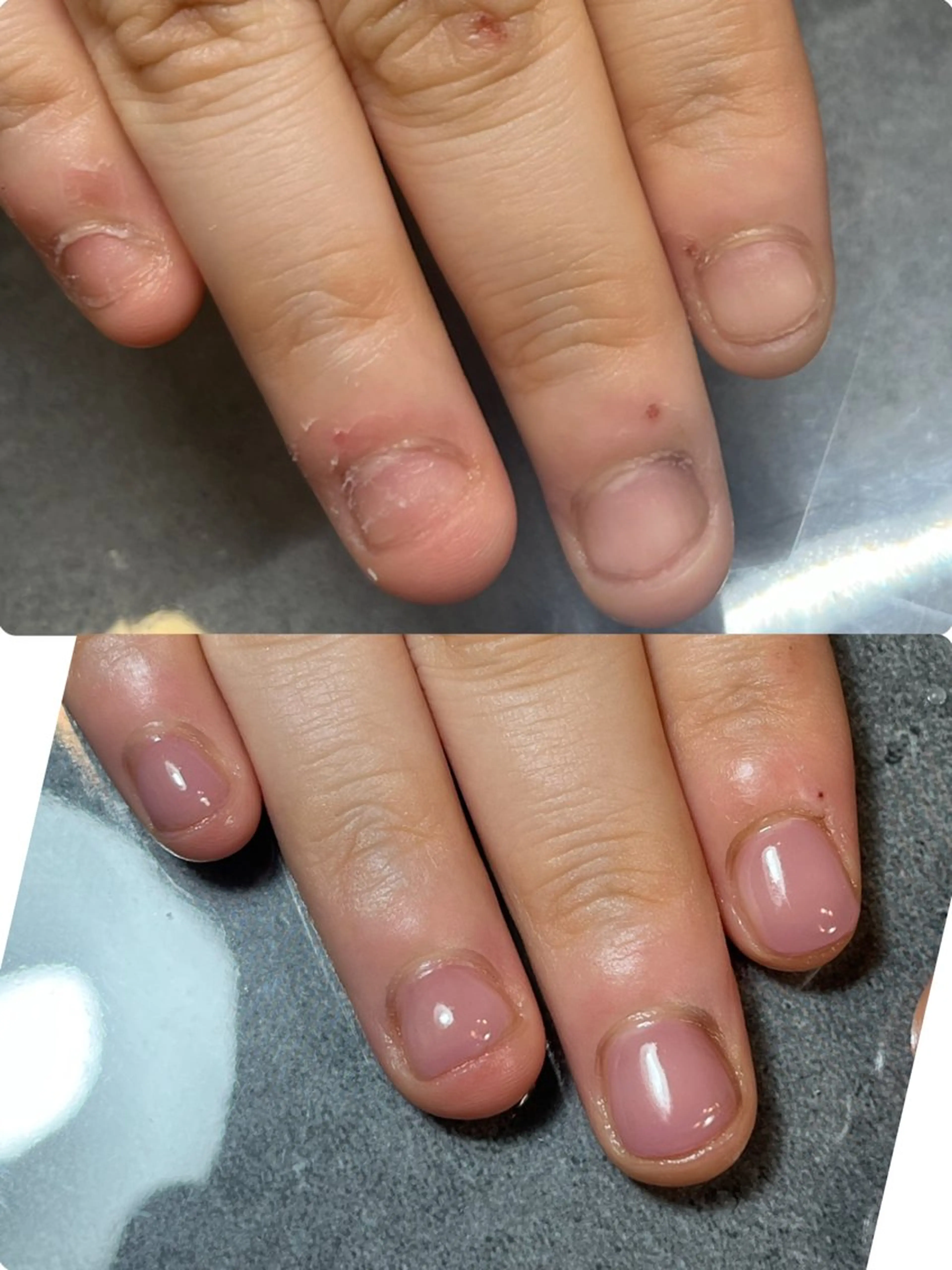 3回セット【最短3ヶ月で褒められる手に】深爪改善(2000円相当のｵｲﾙ付き)※ﾒﾝｽﾞ(男性)歓迎.の写真