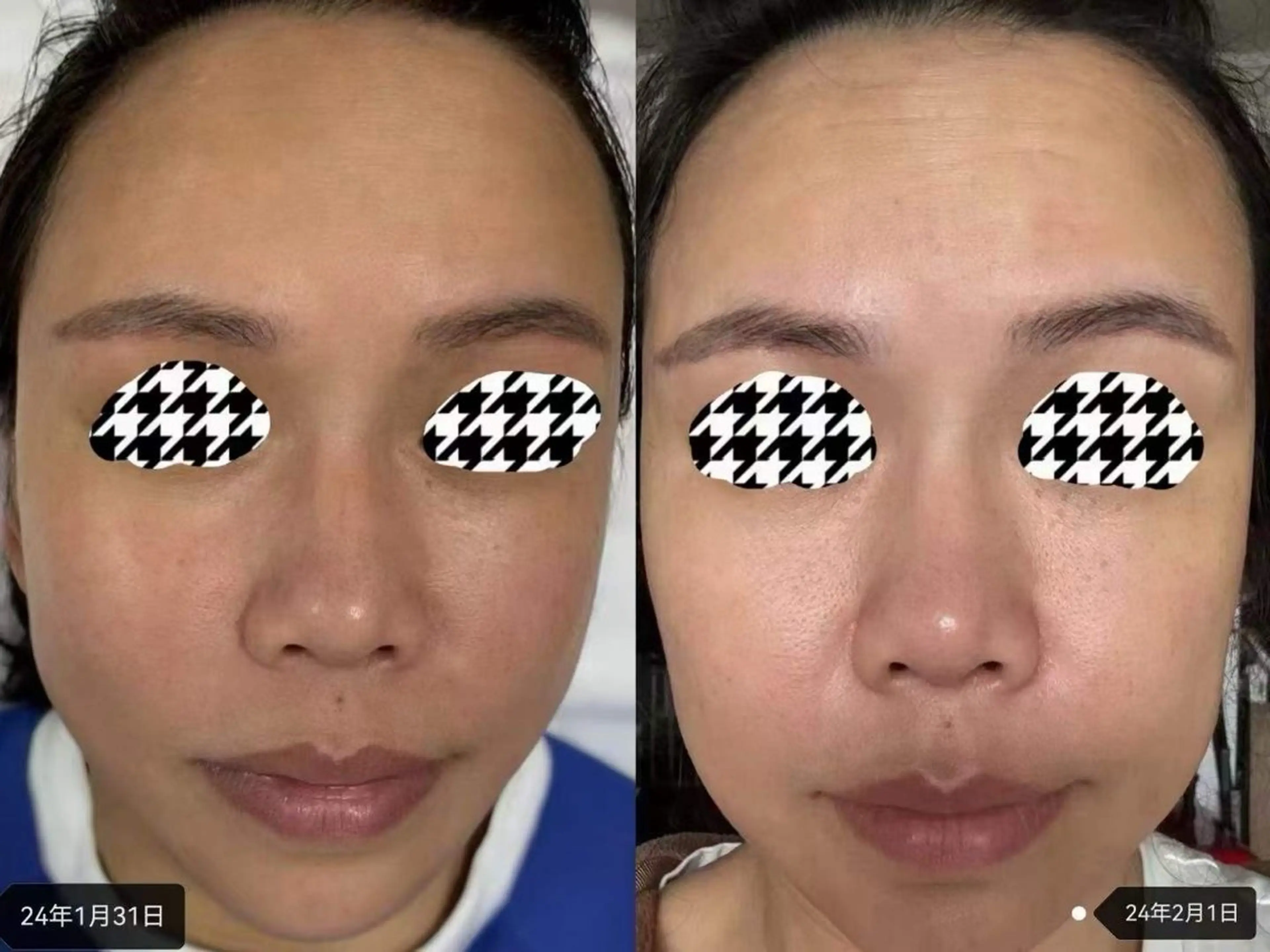 ネイル エステ aliaハーブ水光店 エステティシャン募集のエステ・リラクイメージ