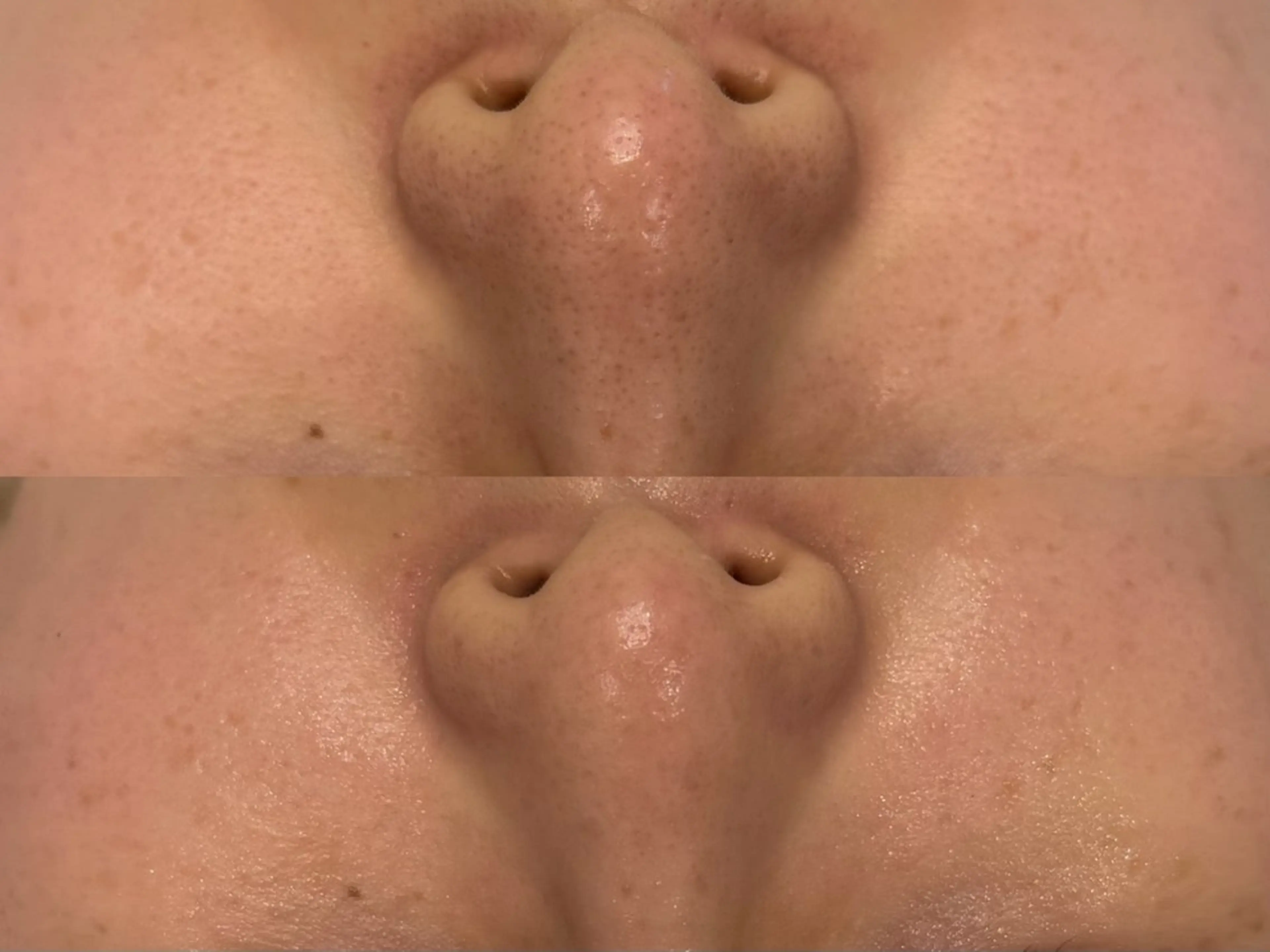 小顔/毛穴/ニキビ salon bealのエステ・リラクイメージ