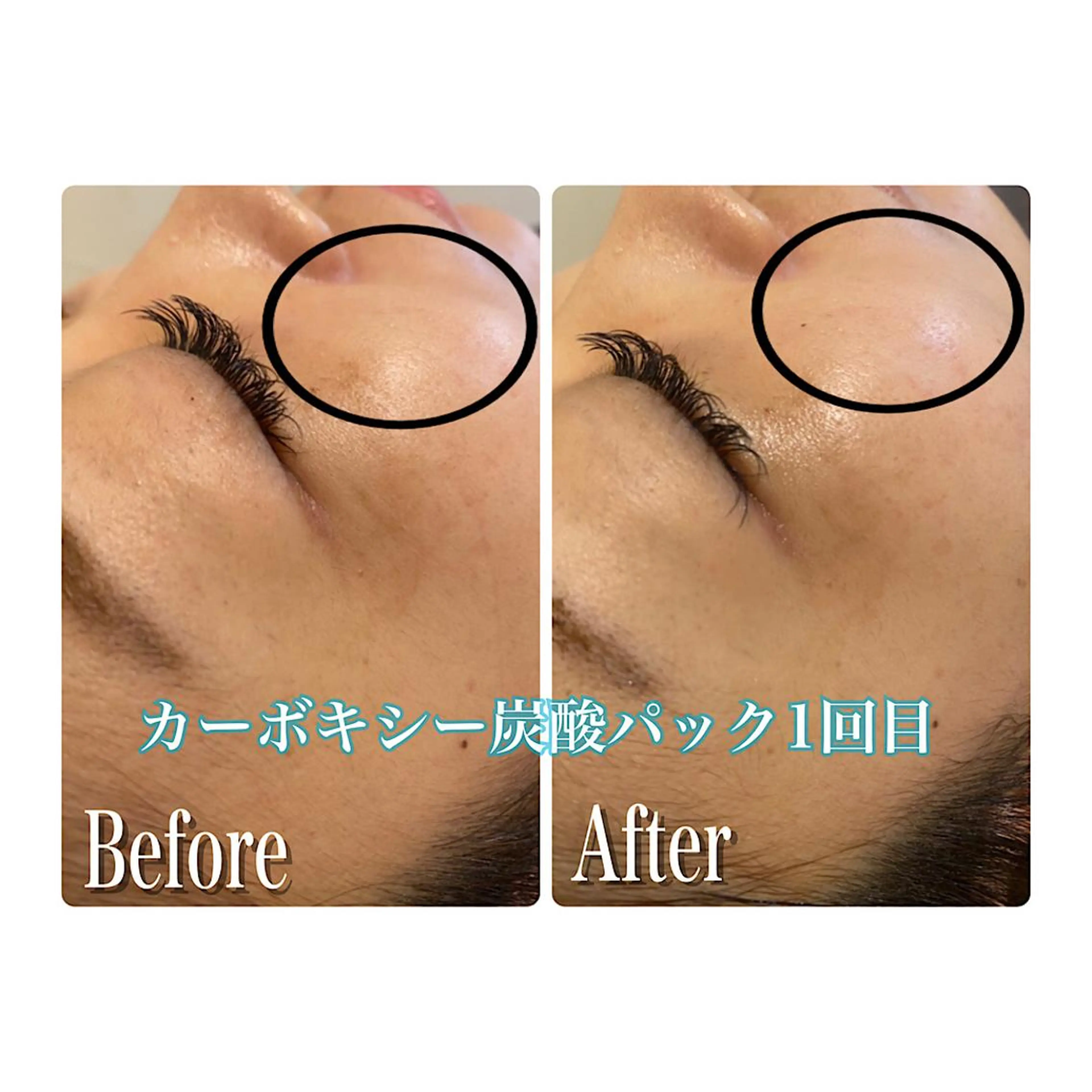 鍼灸 Refineのその他イメージ