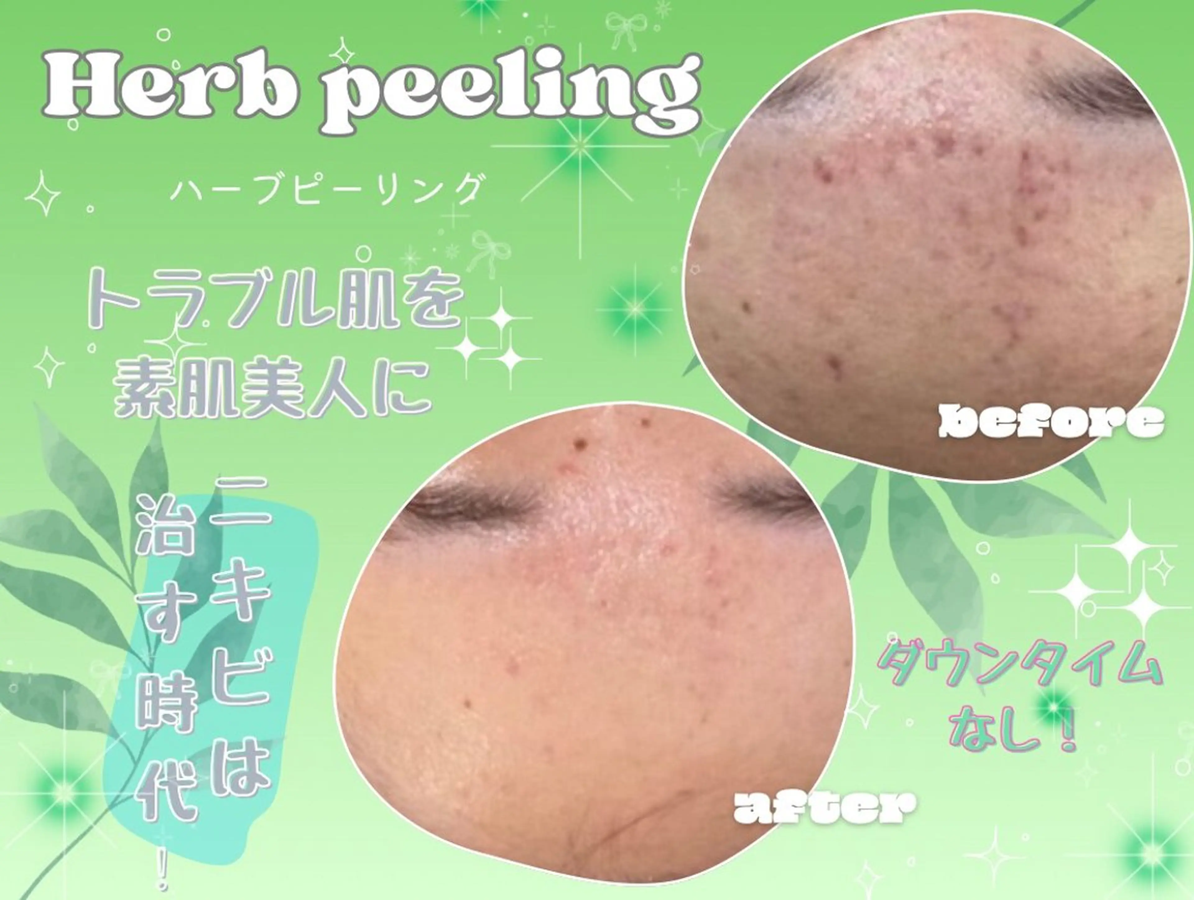 エステ リラク 肌質改善サロン réposのその他イメージ