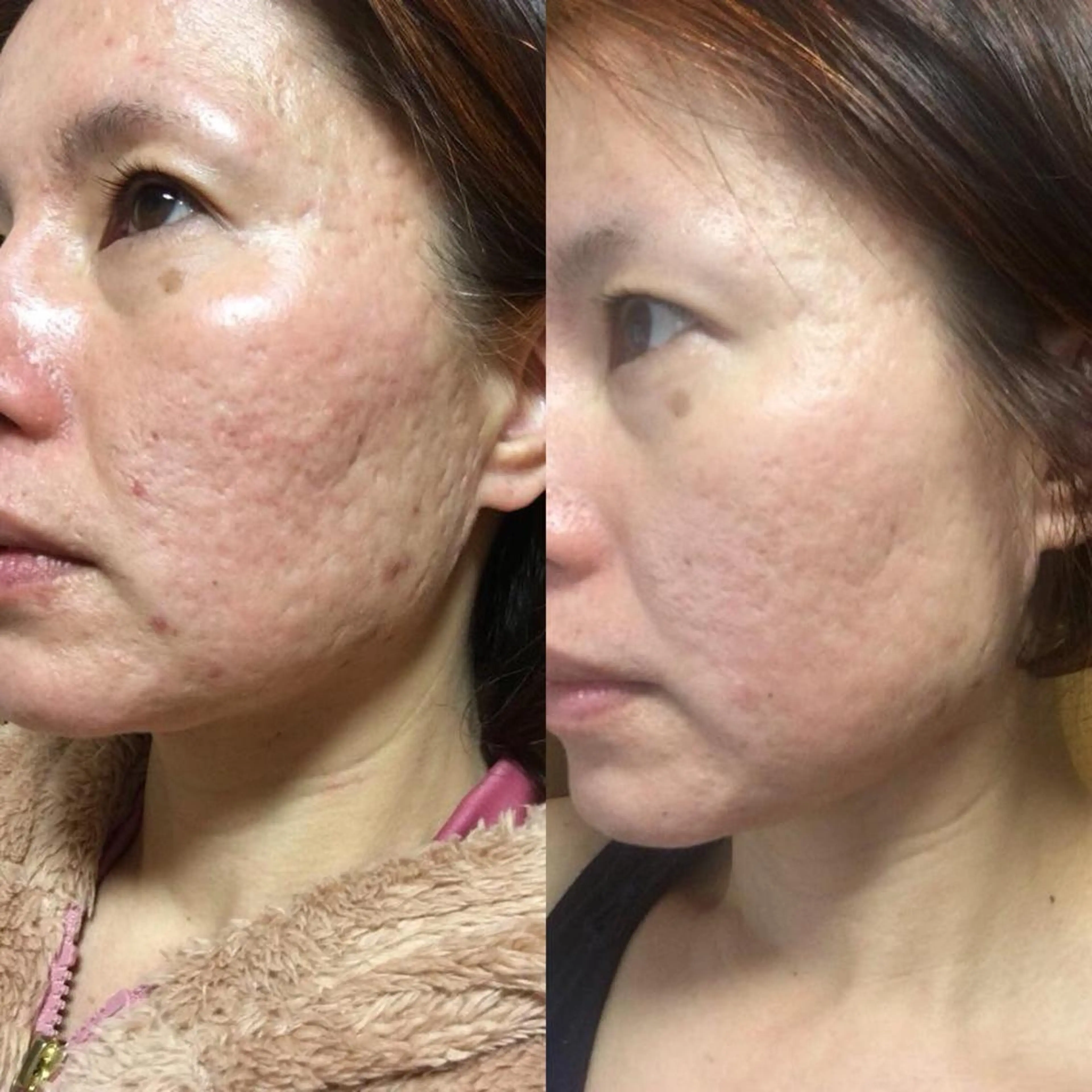 hotty ホッティーのエステ・リラクイメージ