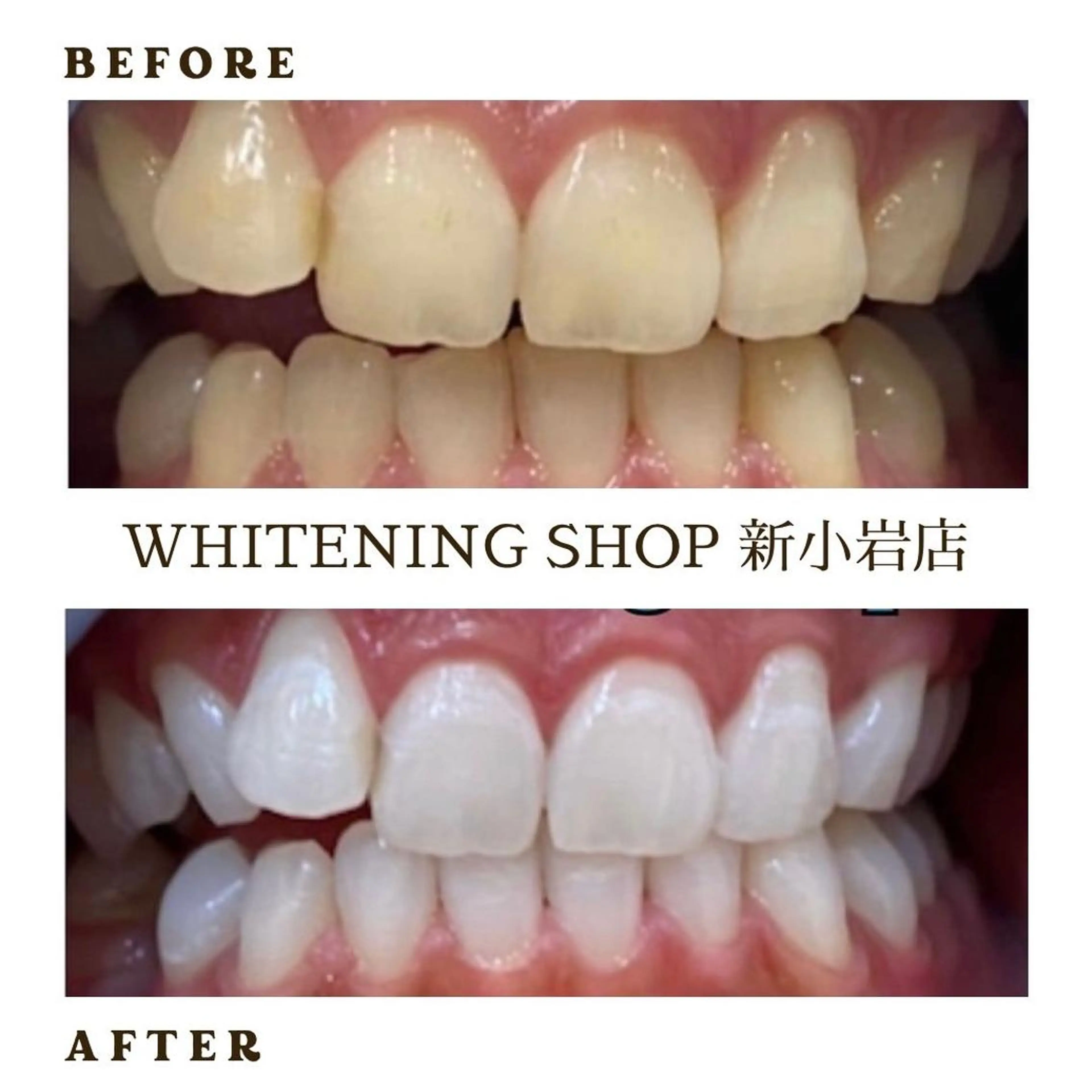 メンズ その他 ホワイトニング ショップ新小岩店のその他イメージ