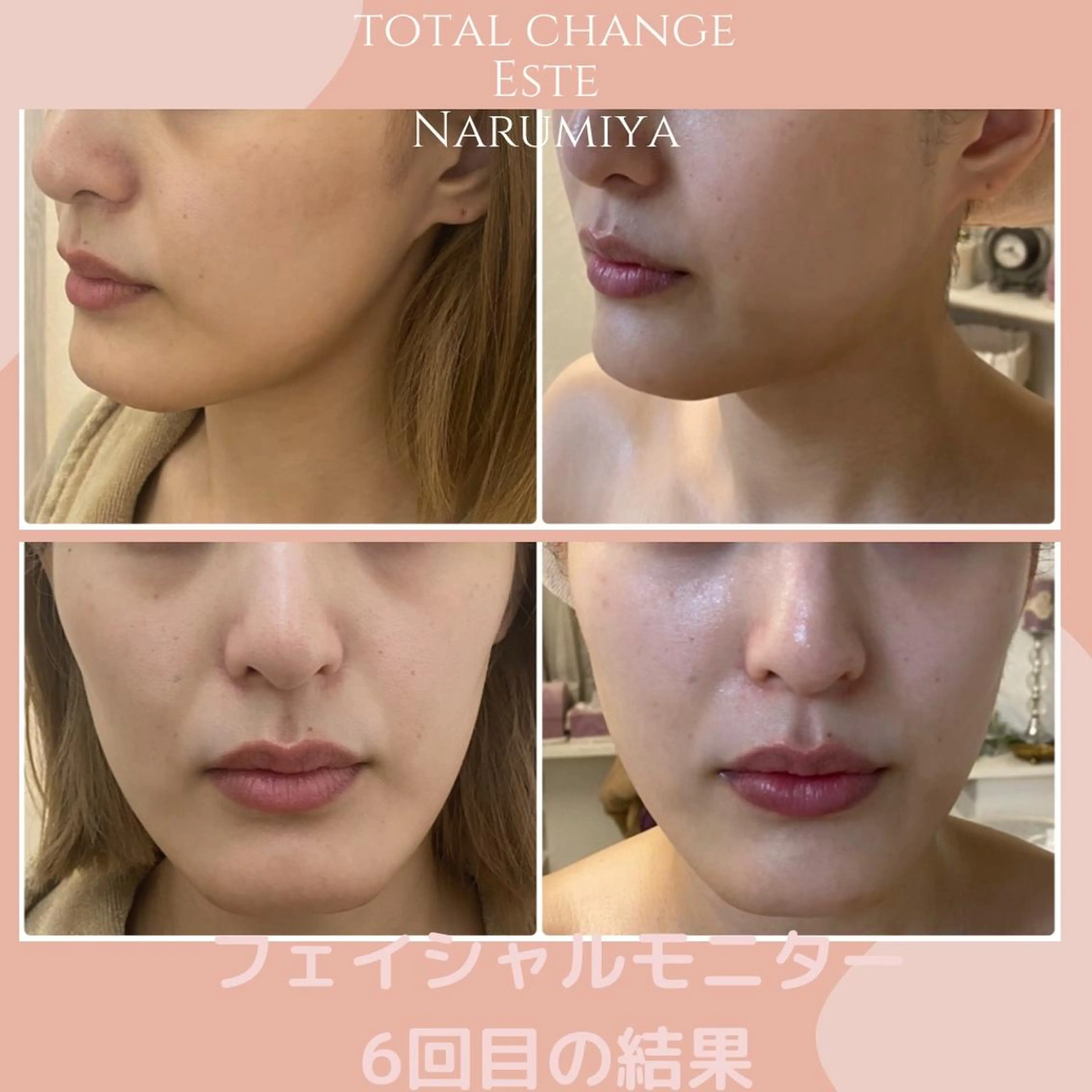 エステ 辻 佐耶のエステ・リラクイメージ