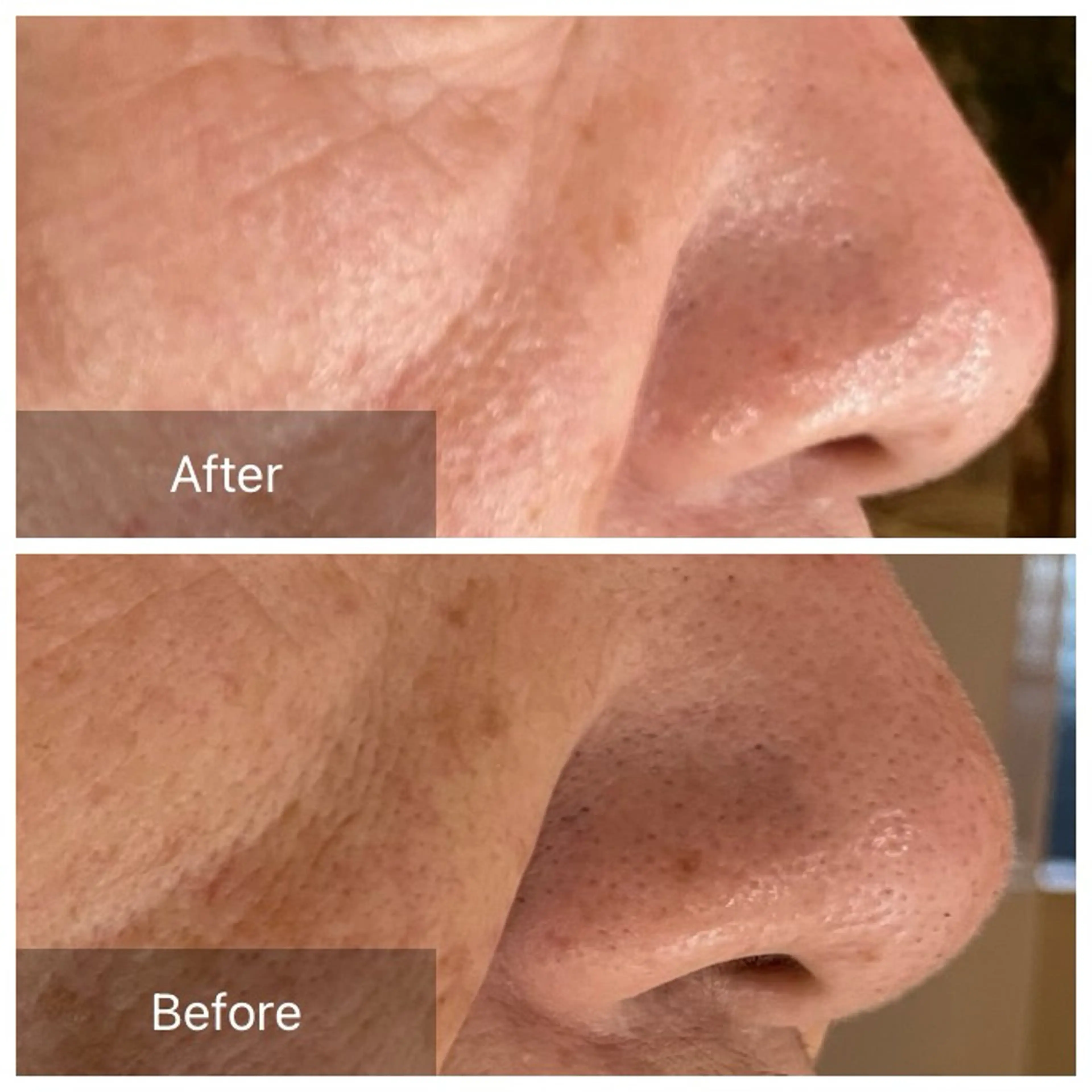 エステ 美肌エイジングケアサロンIB所属・IB 内藤のエステ・リラクイメージ