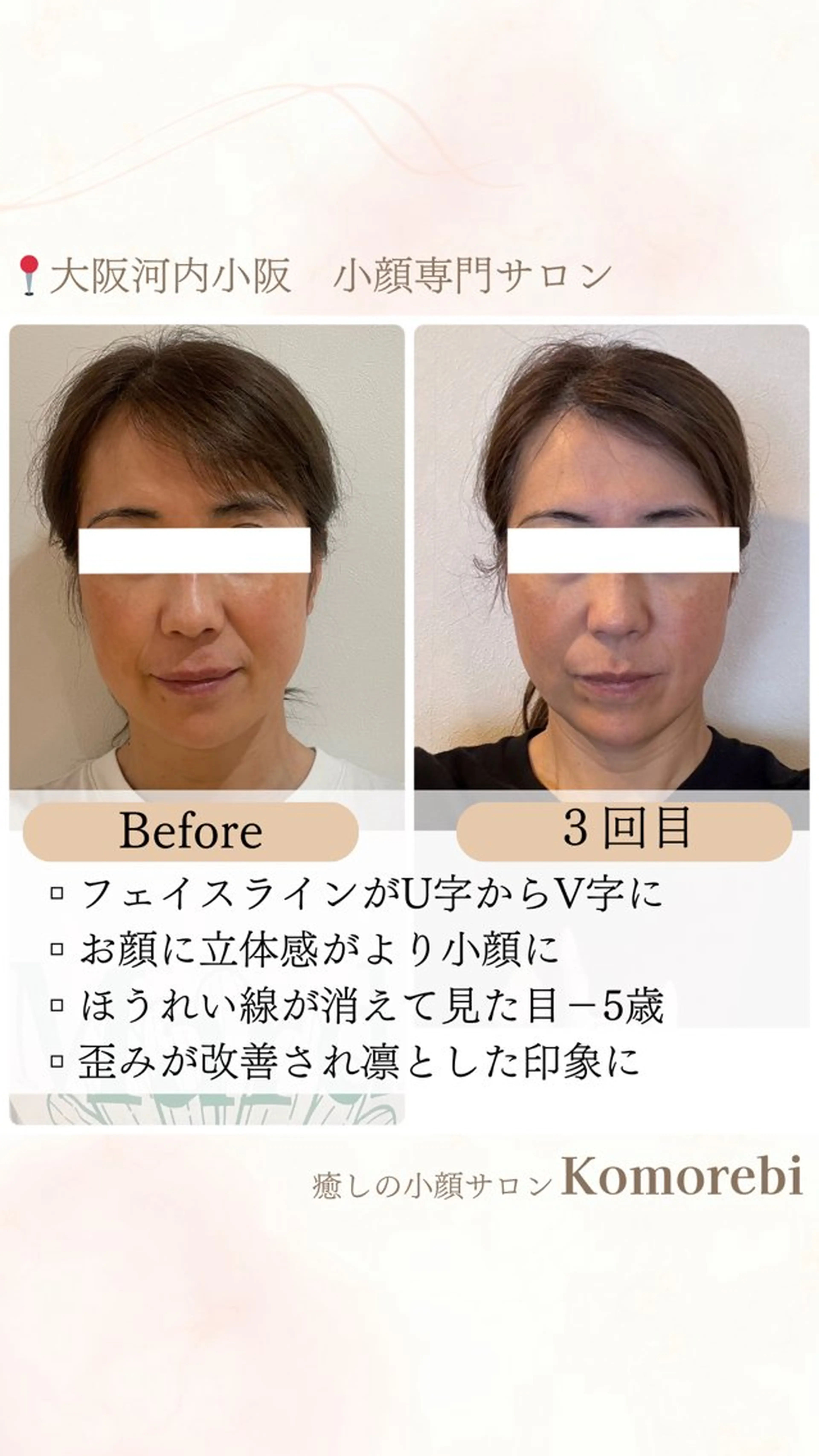 営業電話❌小顔サロン Komorebiのエステ・リラクイメージ