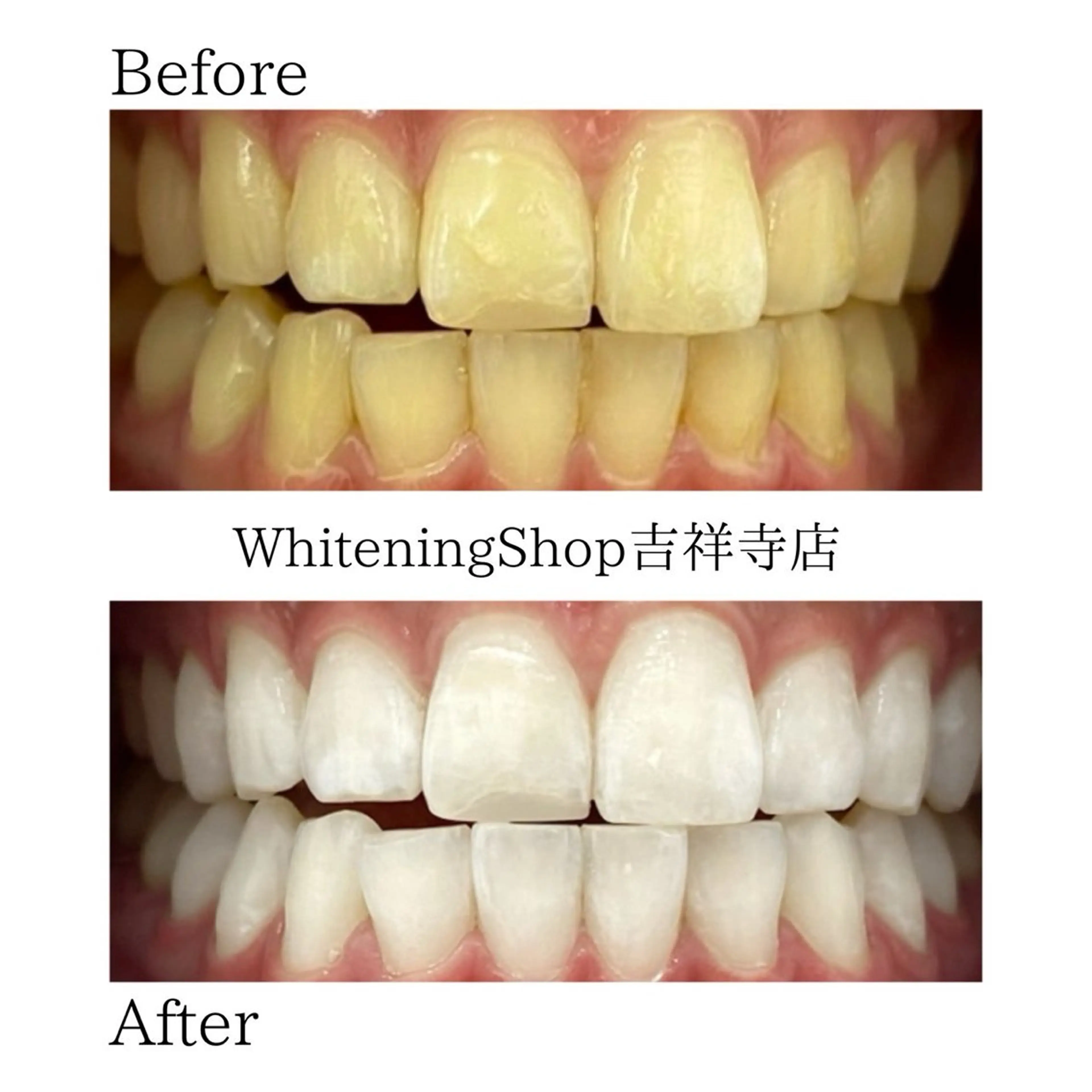 ホワイトニング ショップ吉祥寺店のエステ・リラクイメージ