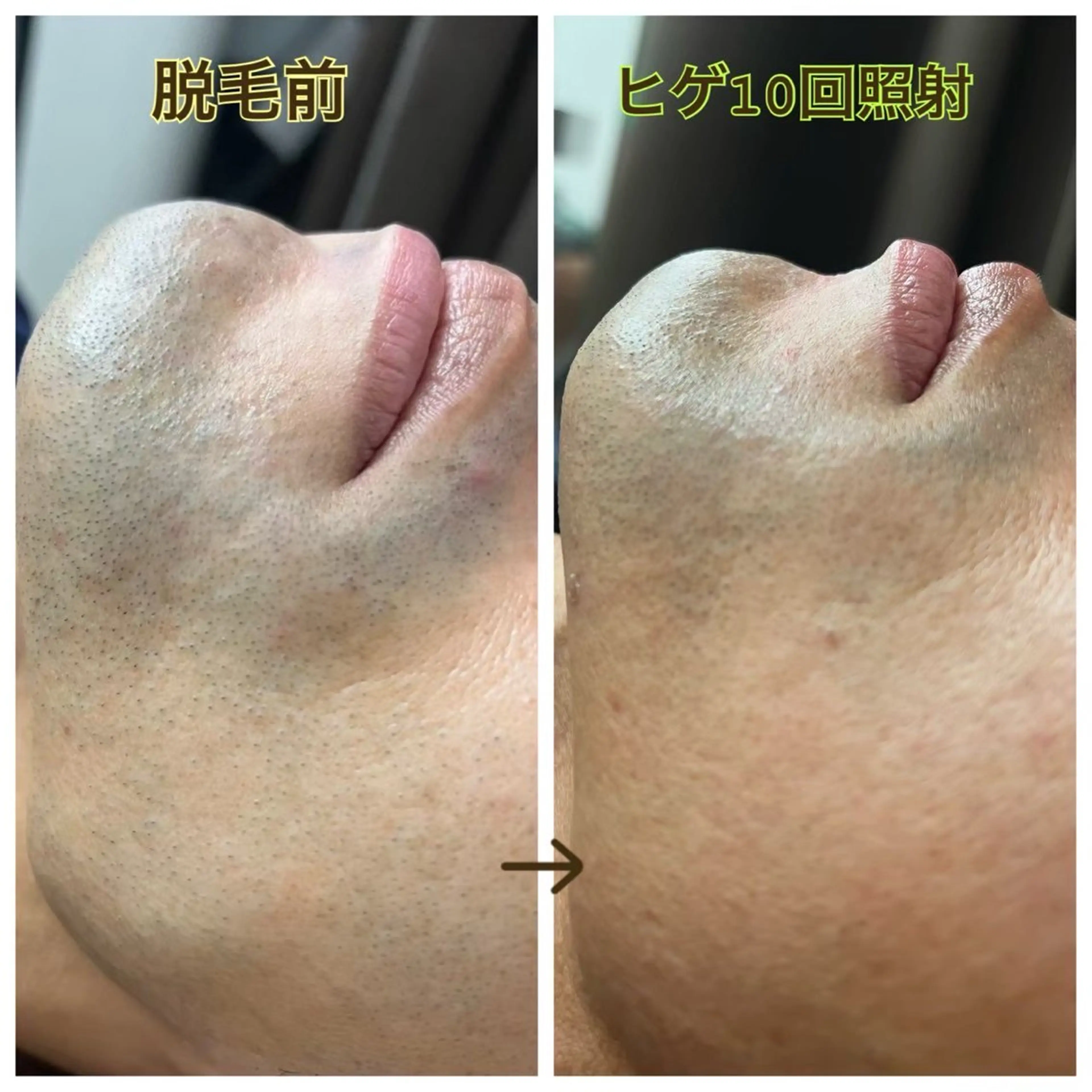 MINOA 井上🌷のエステ・リラクイメージ