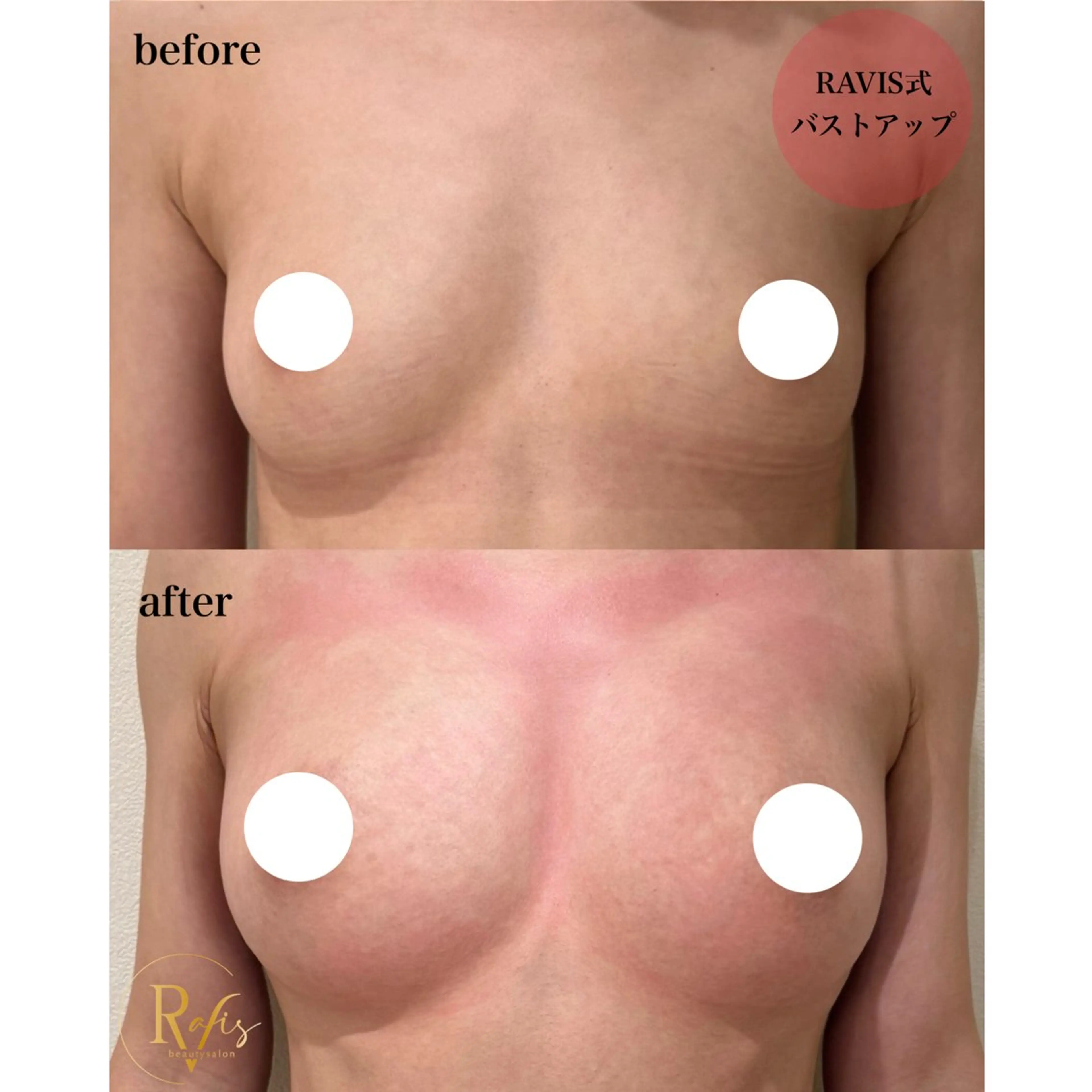 エステ 東大阪/韓国肌管理/ 痩身バスト専門店のエステ・リラクイメージ