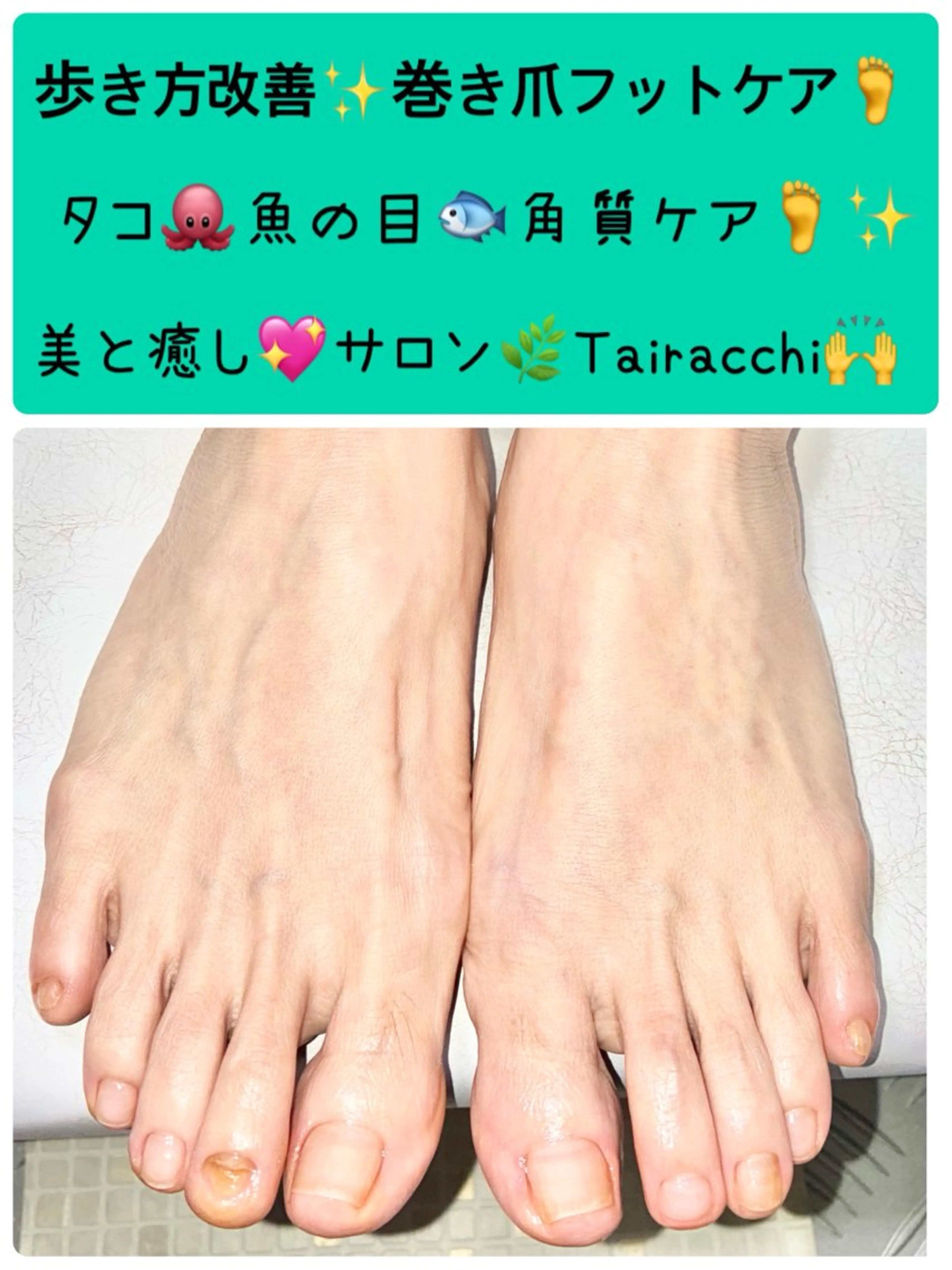 ネイル フットネイル Tairacchi ﾀｲﾗｯﾁのエステ・リラクイメージ