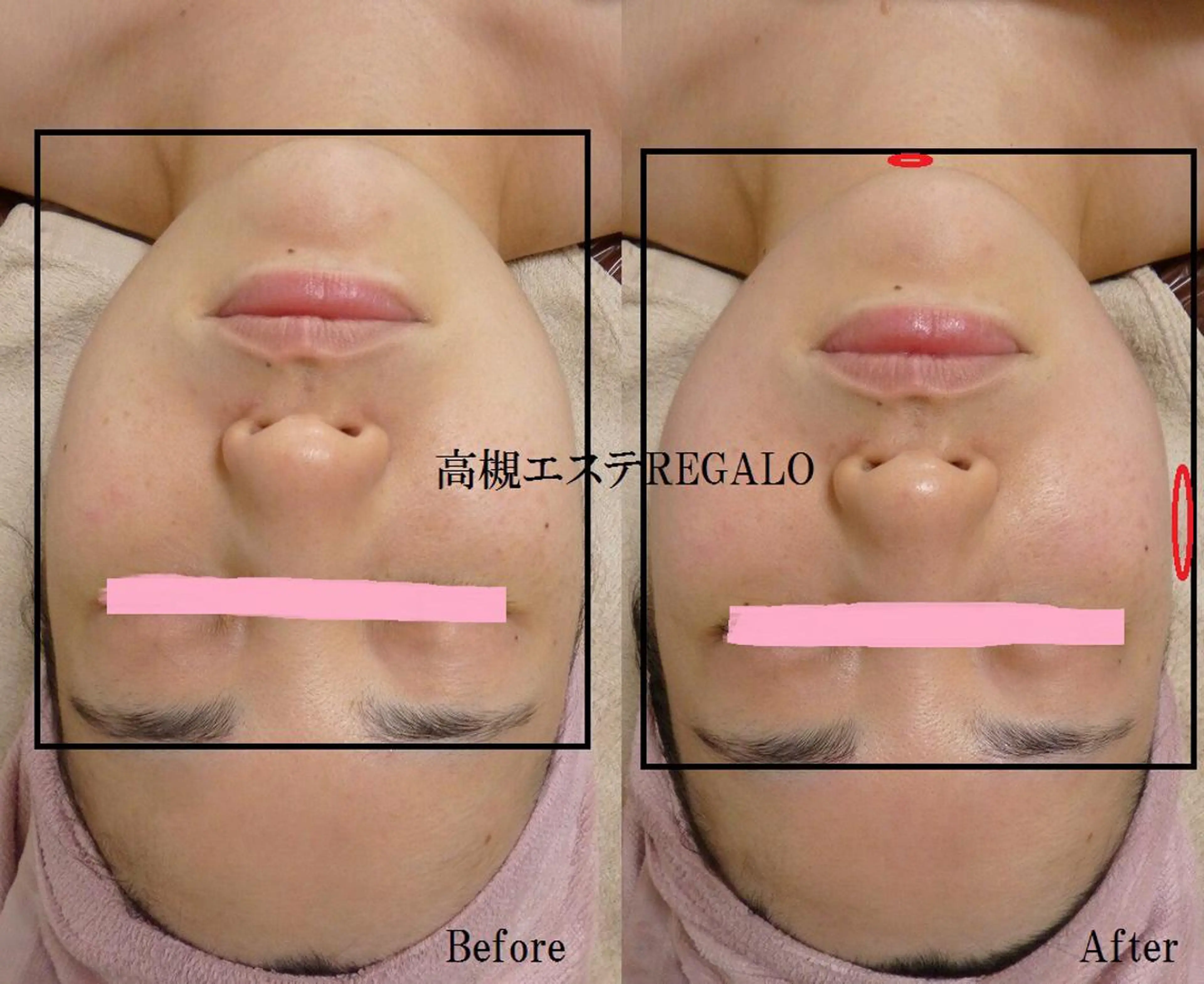 エステ REGALO所属・矢野 さやかのエステ・リラクイメージ