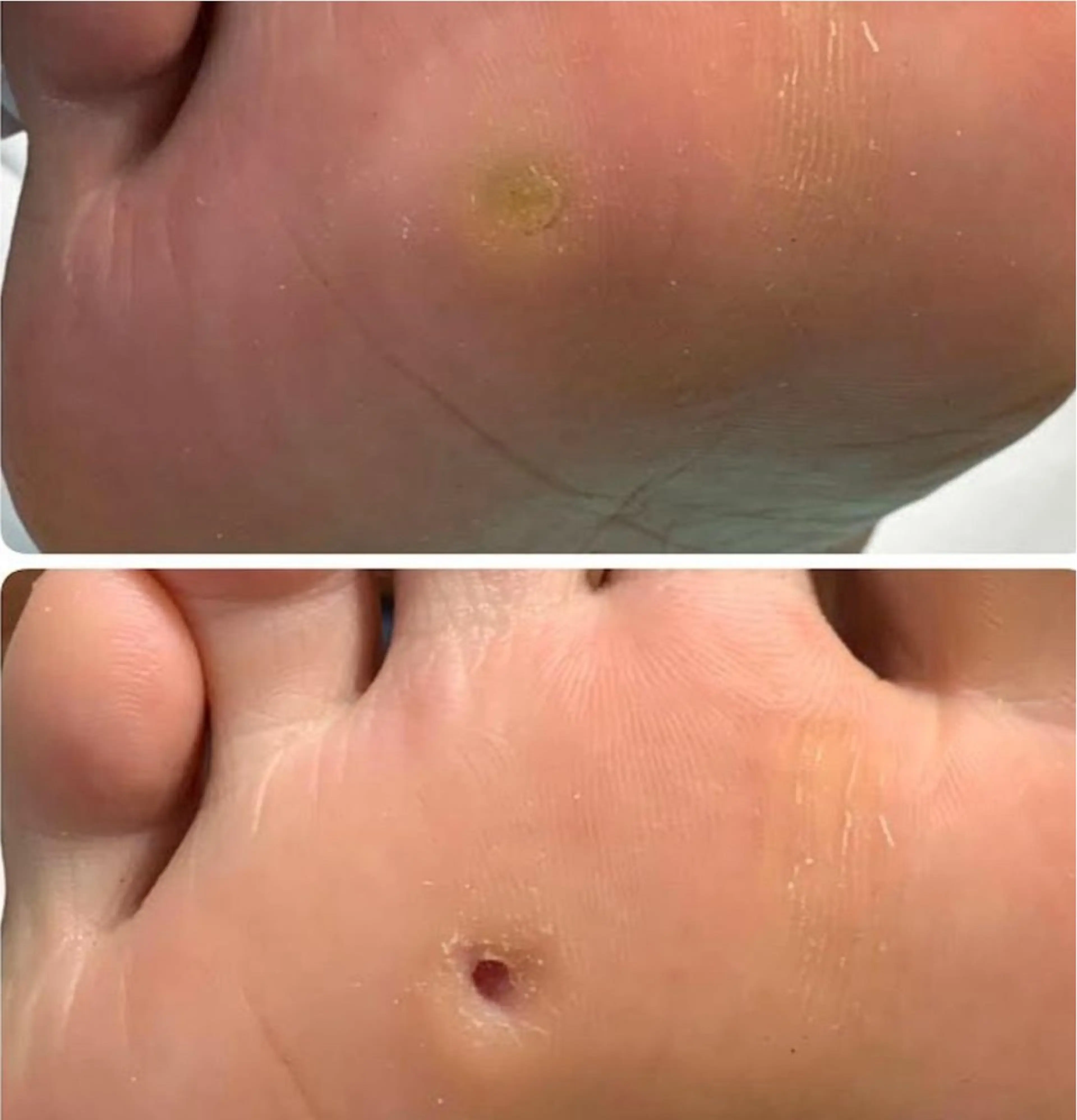 リラク 福岡巻き爪補正店 博多店のエステ・リラクイメージ