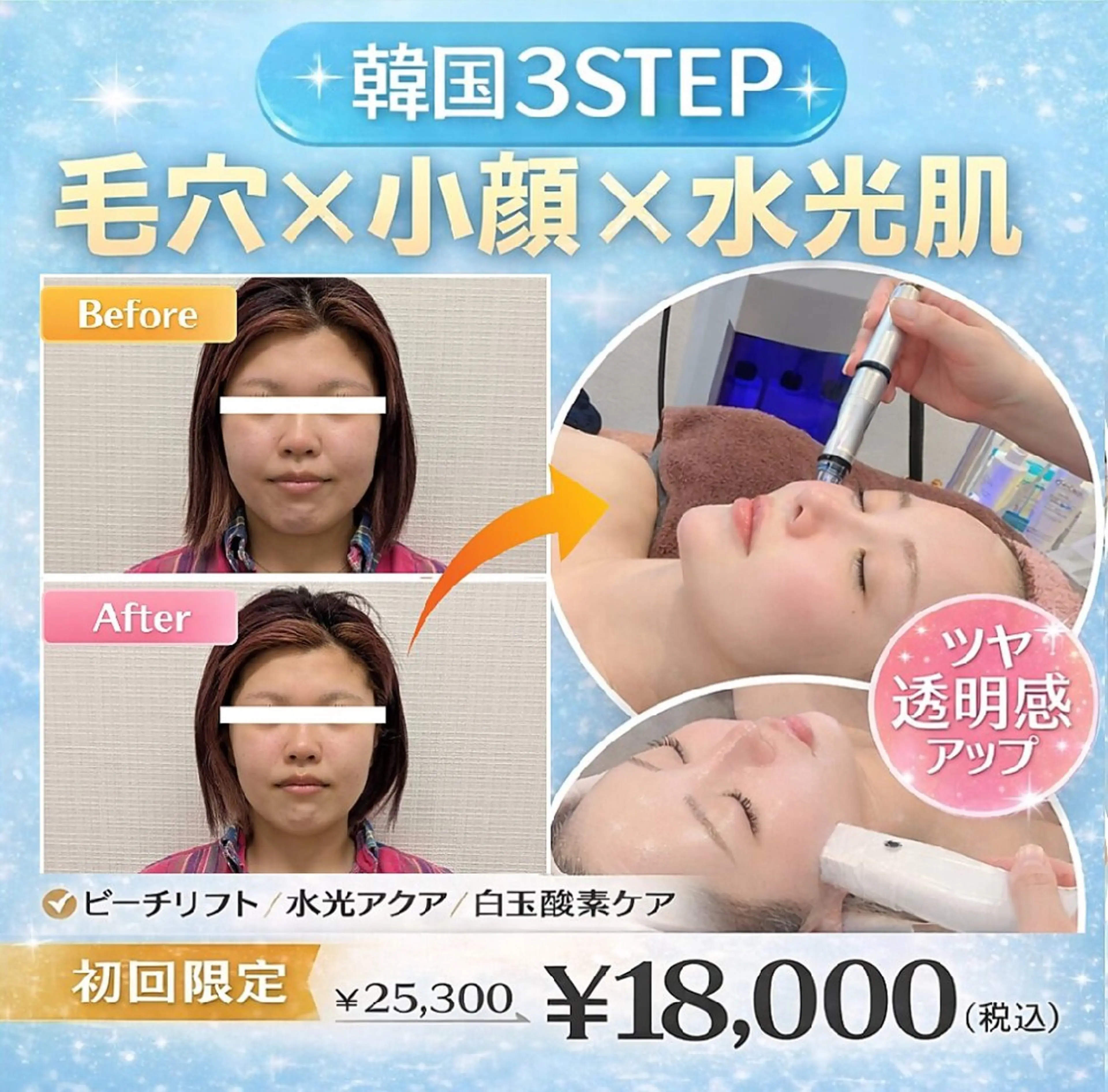 【毛穴洗浄×韓国水光肌】ピーチリフト＋水光アクア＋白玉酸素 通常¥25,300→¥18,000の写真