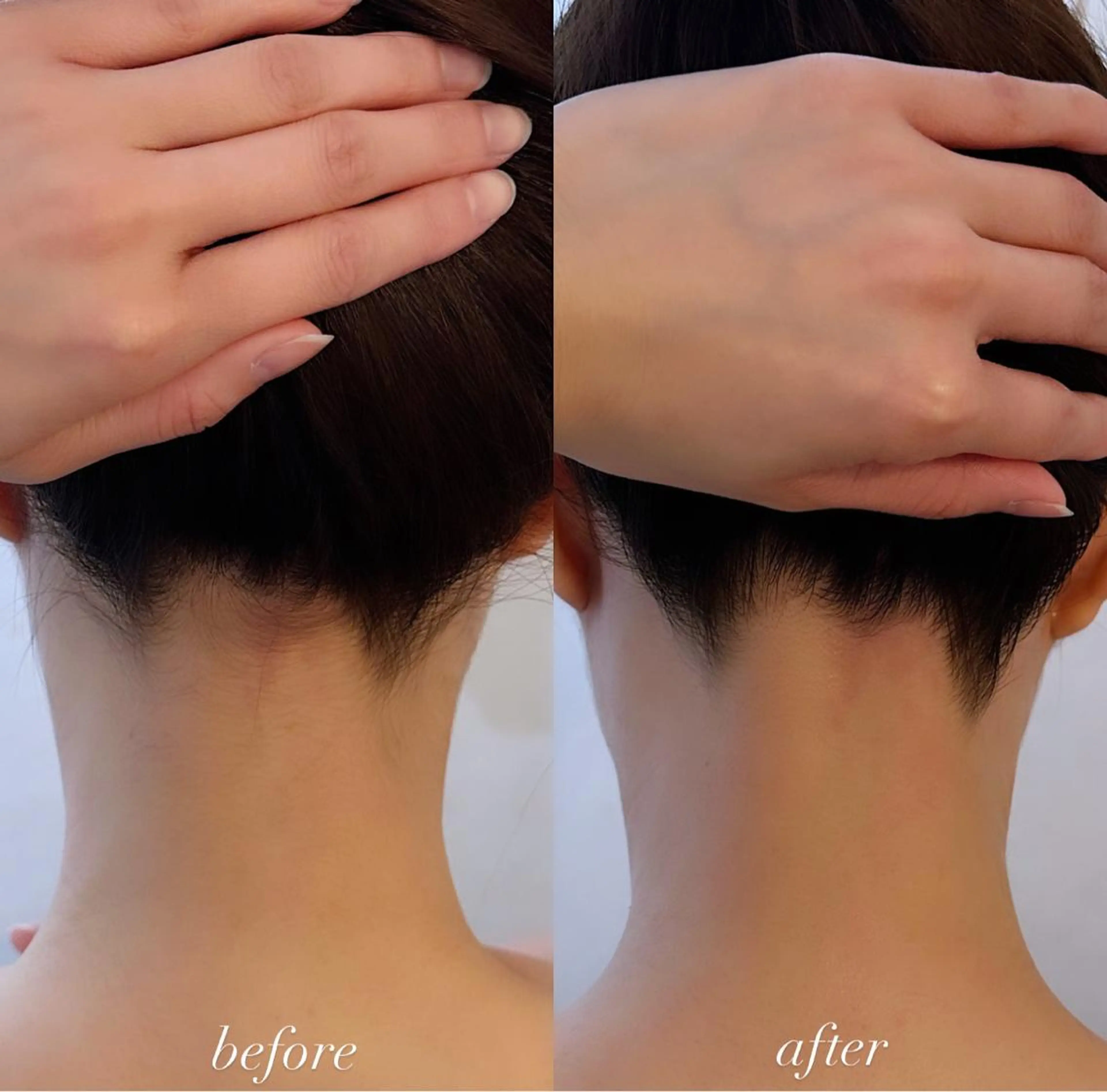 うなじ脱毛/美肌脱毛 LABELのエステ・リラクイメージ